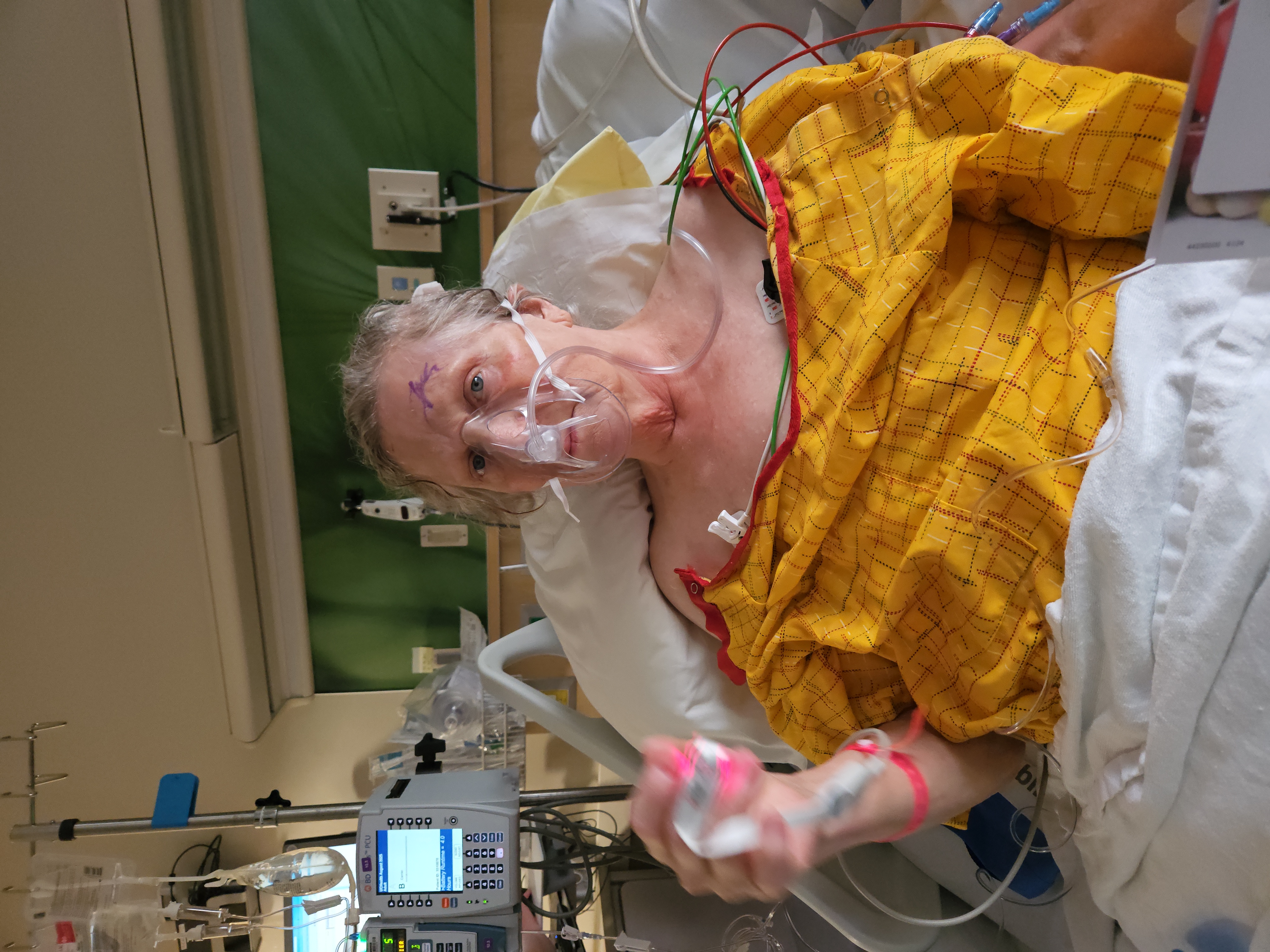Join Vikki's Fight Against Rare Fungal Brain Infection campaign photo, 5 of 8