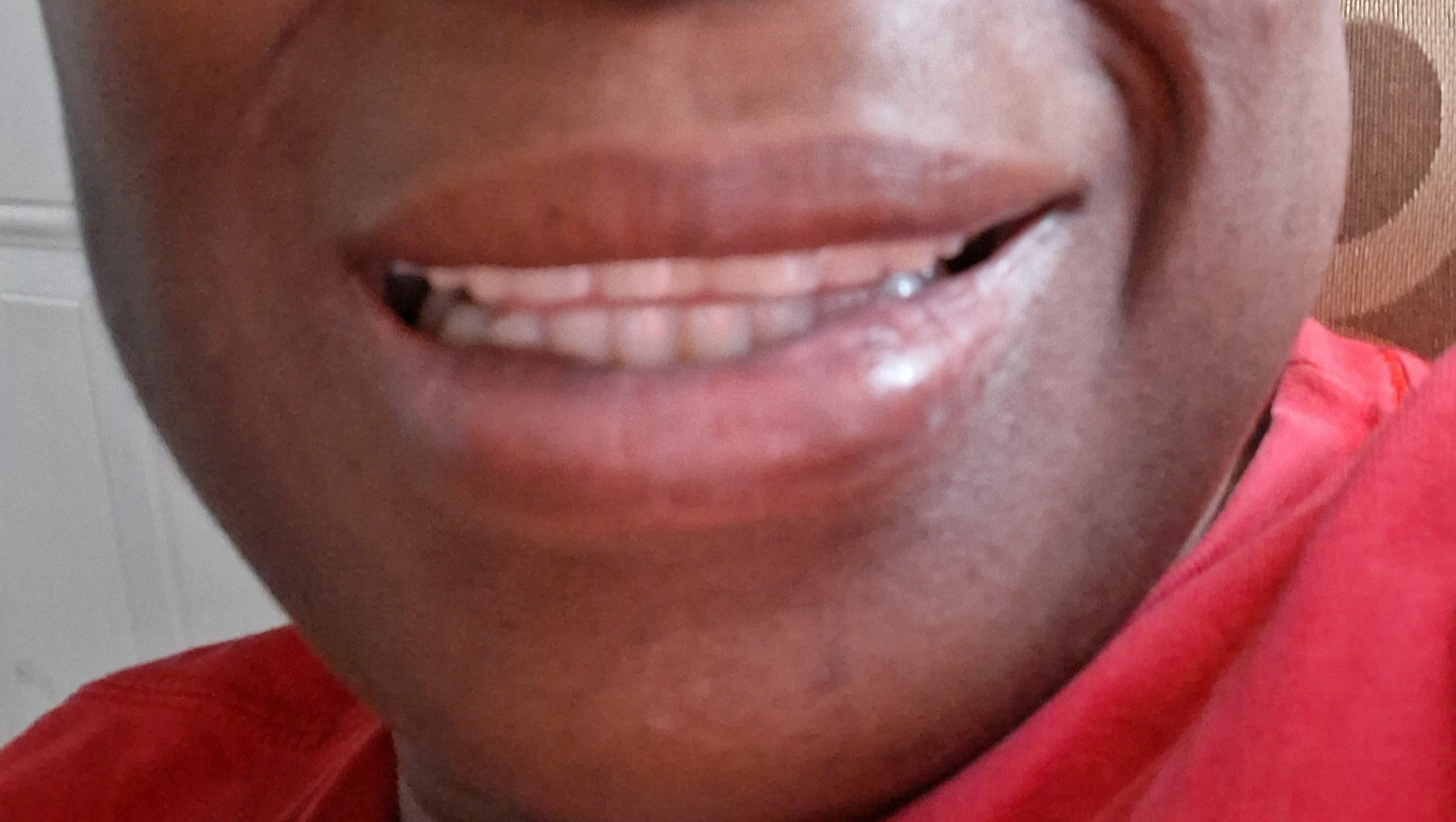 Please help Olaitan continue to smile during this rough time photo