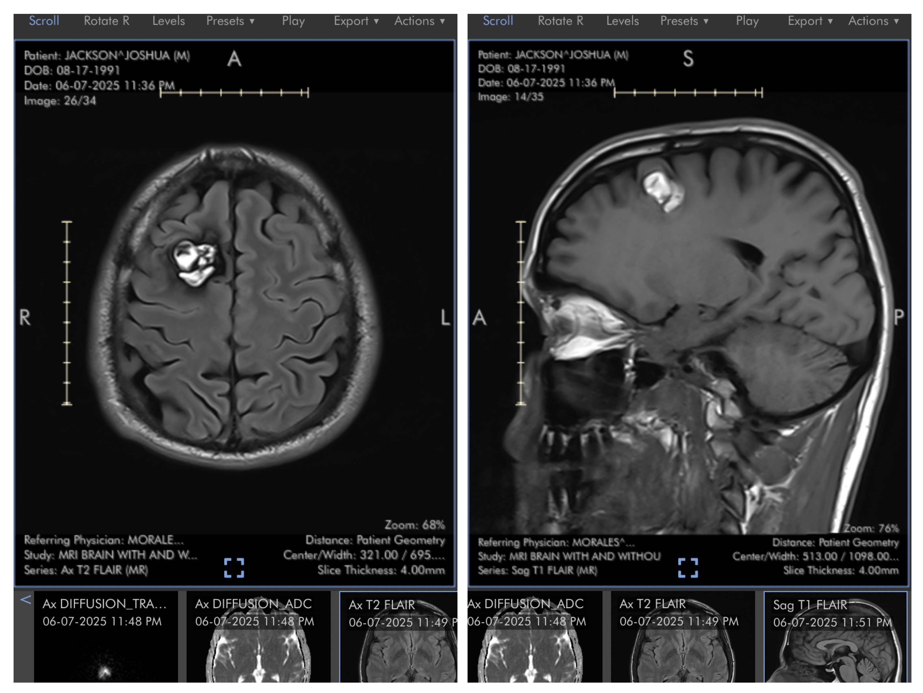 Help Support Josh & Family After Brain Surgery campaign photo, 7 of 8