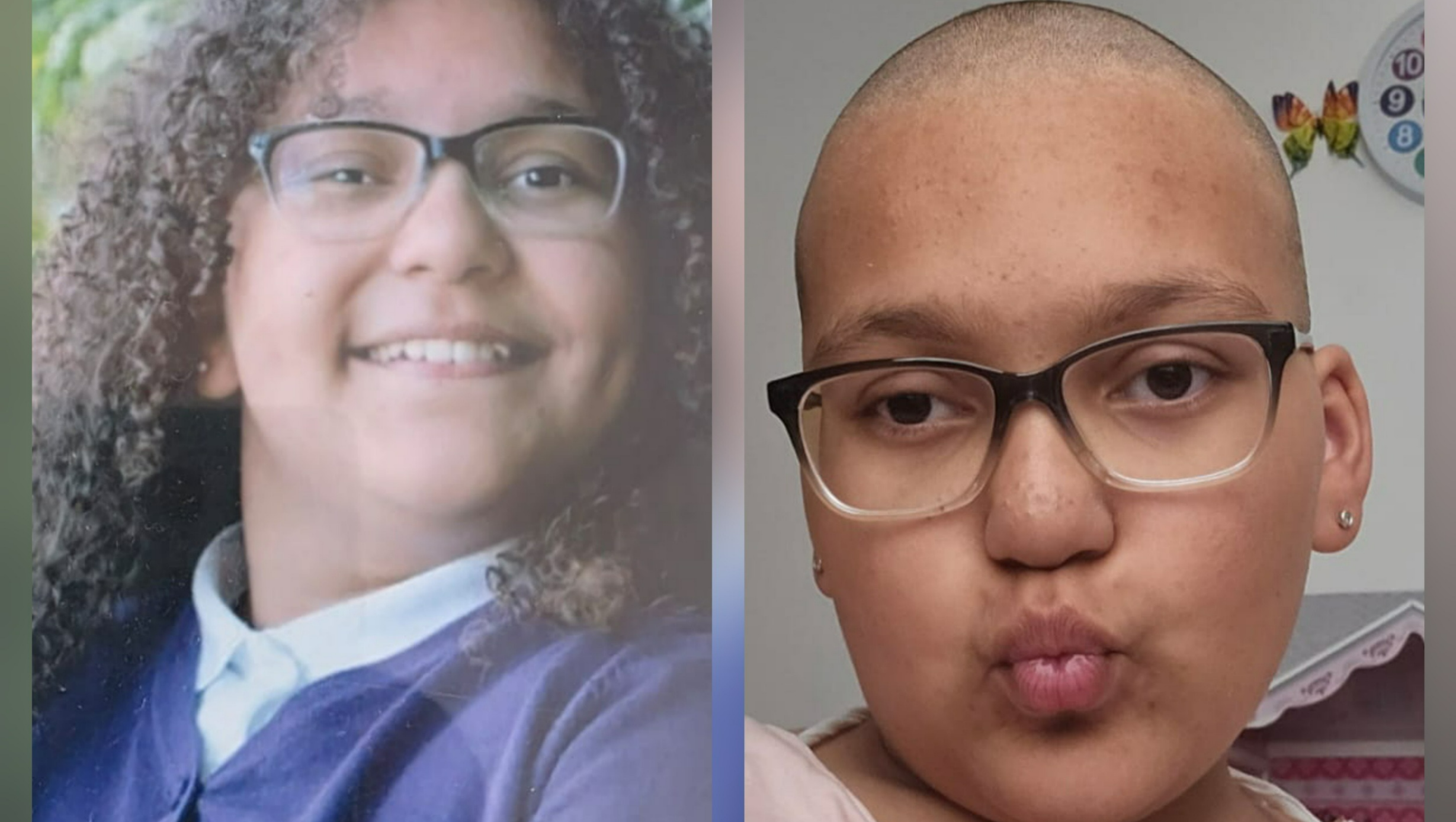 Help Sophia fight a very rare childhood eye cancer photo