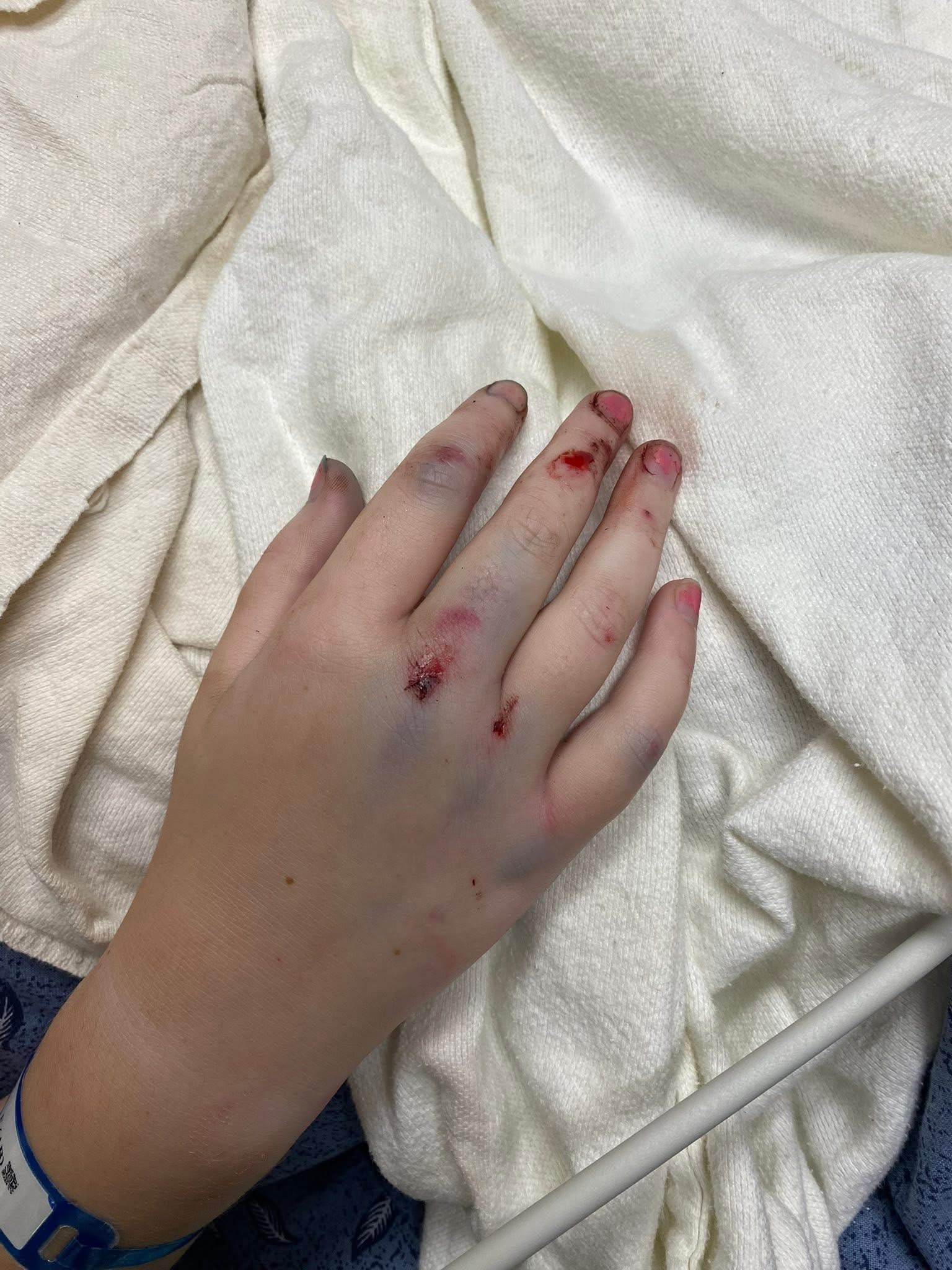 Support Easton and Savannah's Healing Journey campaign photo, 2 of 8