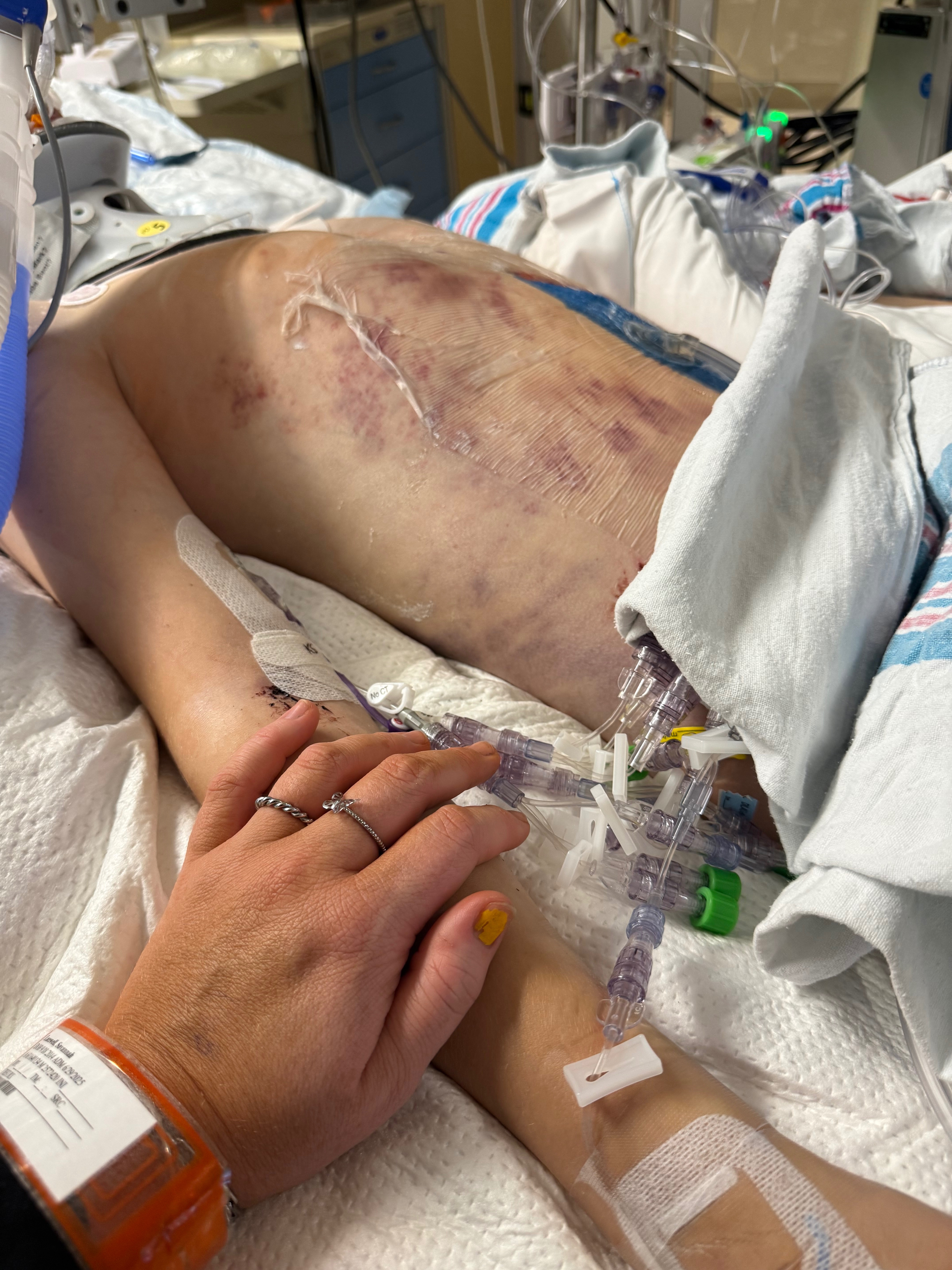 Support Easton and Savannah's Healing Journey campaign photo, 6 of 8