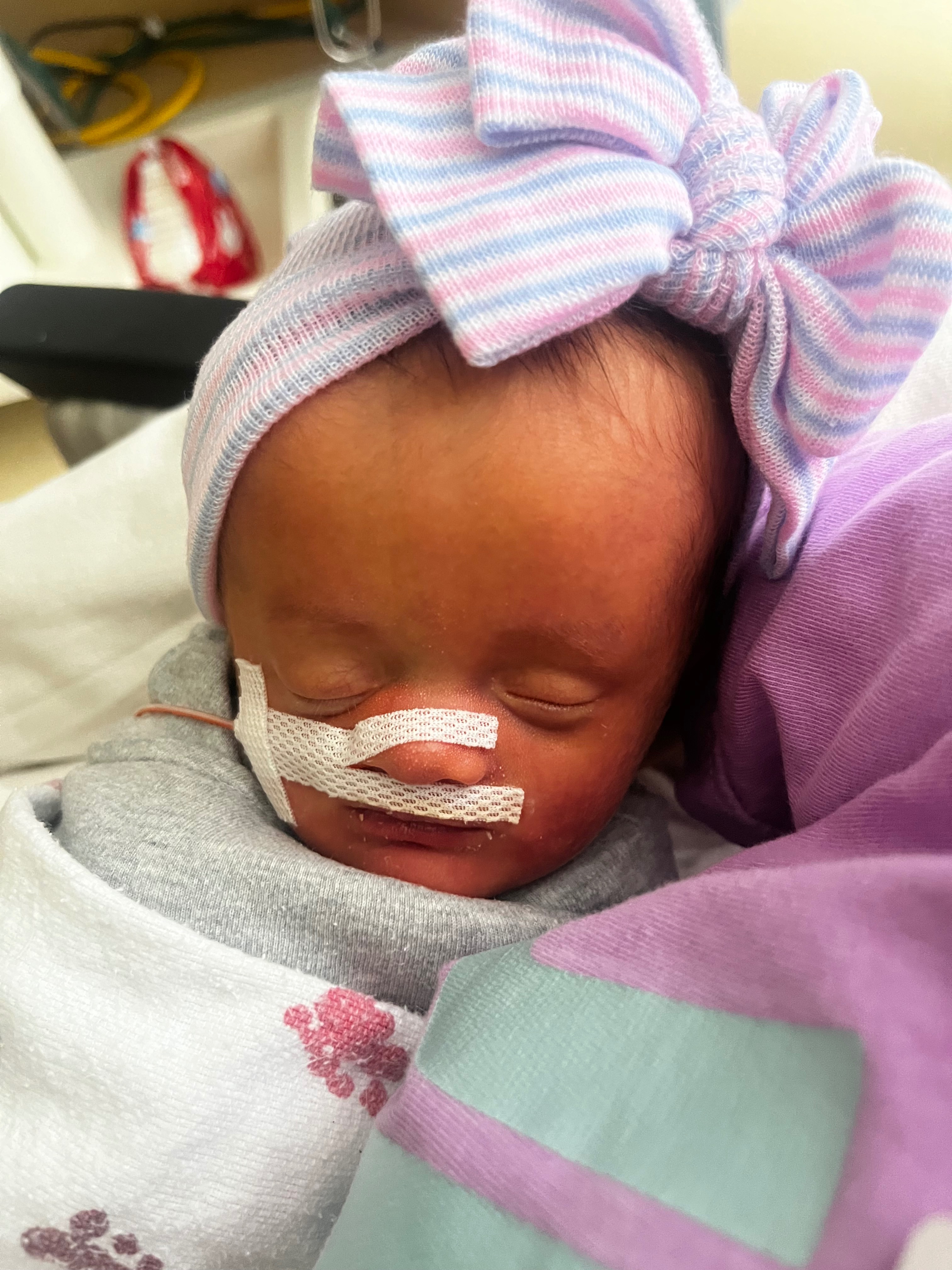 Donate to Baby Tately Dawn's Healing Fund campaign photo, 2 of 4