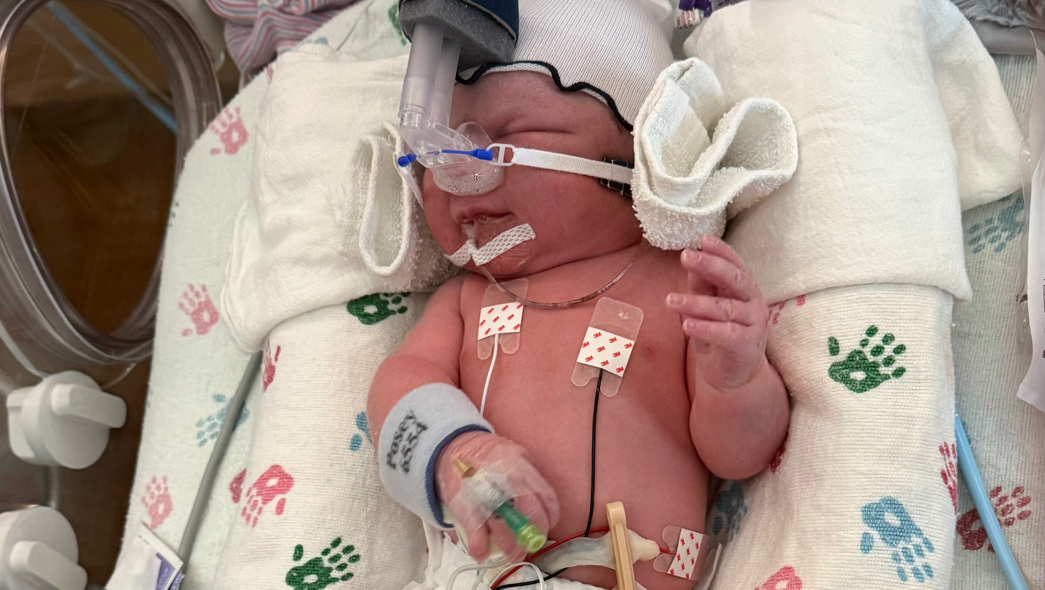 Fundraiser by Katie Meissner : Support Charli's NICU Journey ...
