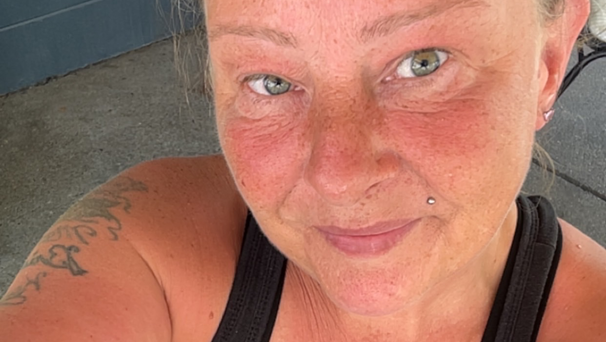 Assist Barbara Edmundson Through Surgery Recovery photo