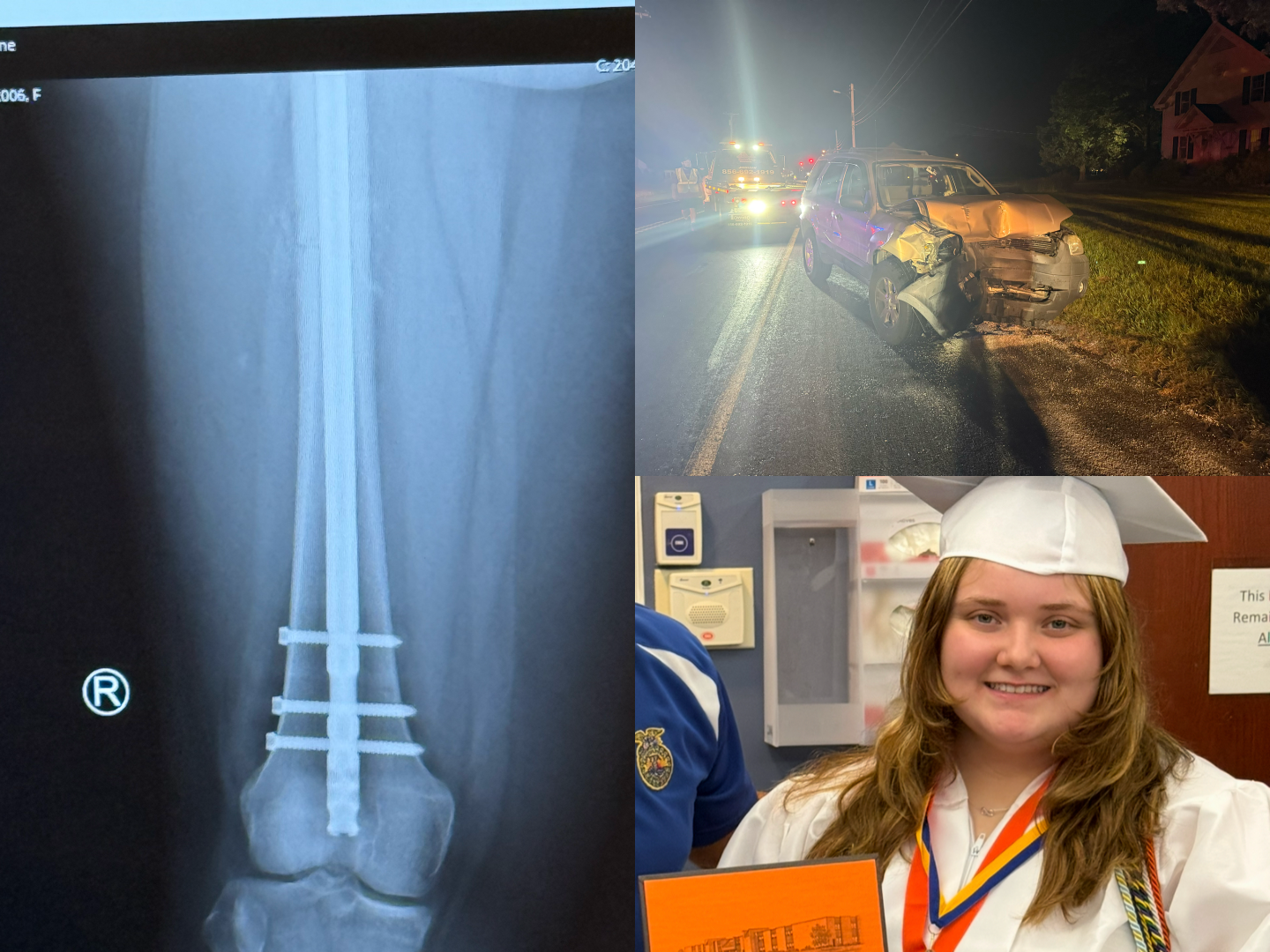 Support Kailynne's Recovery and College Dreams campaign photo, 6 of 7