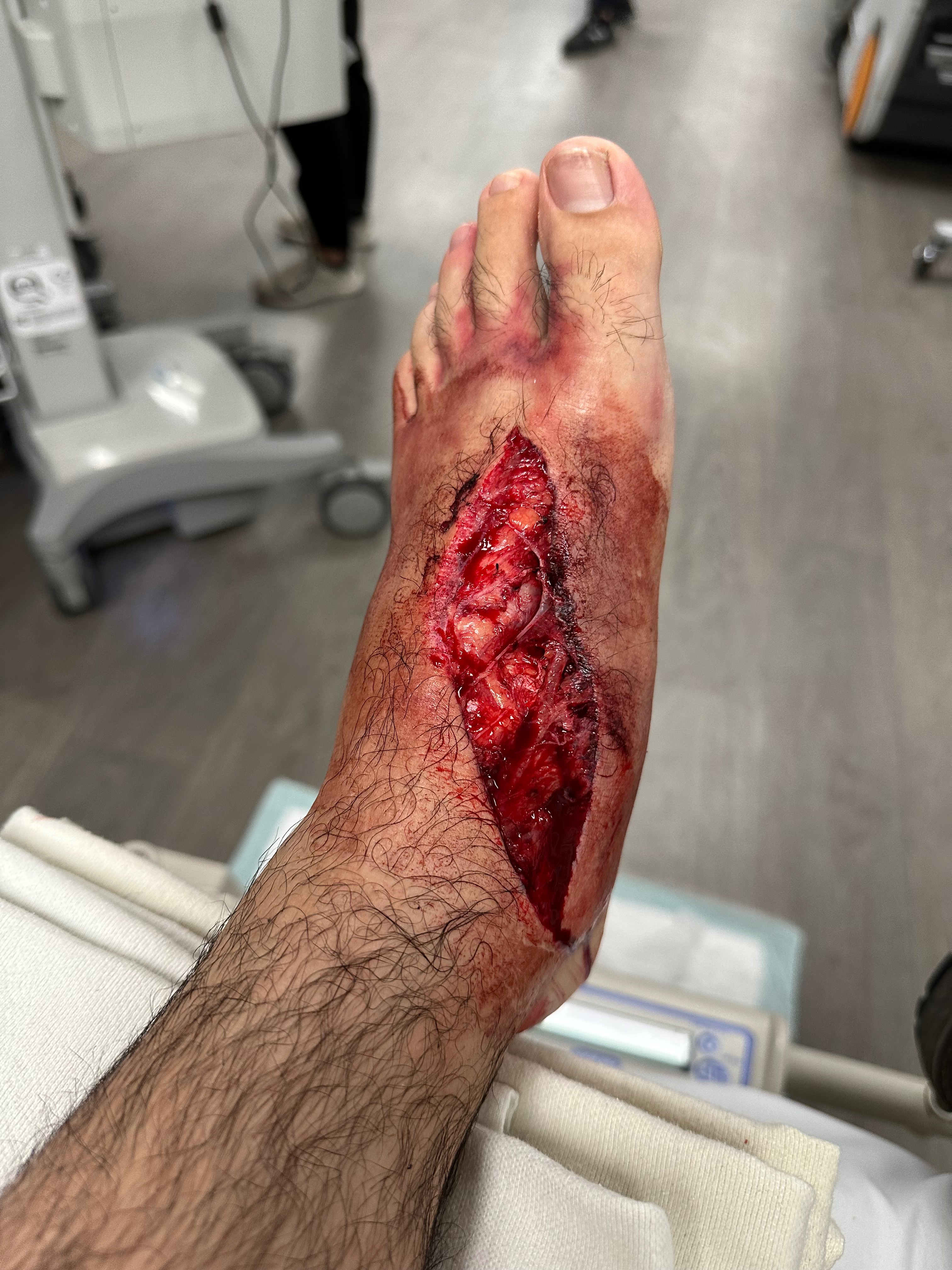 Support Christian’s Recovery After Foot Injury campaign photo, 4 of 6