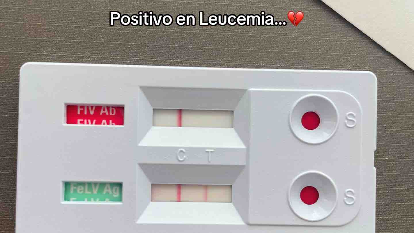 Michi acaba de dar positivo en leucemia photo
