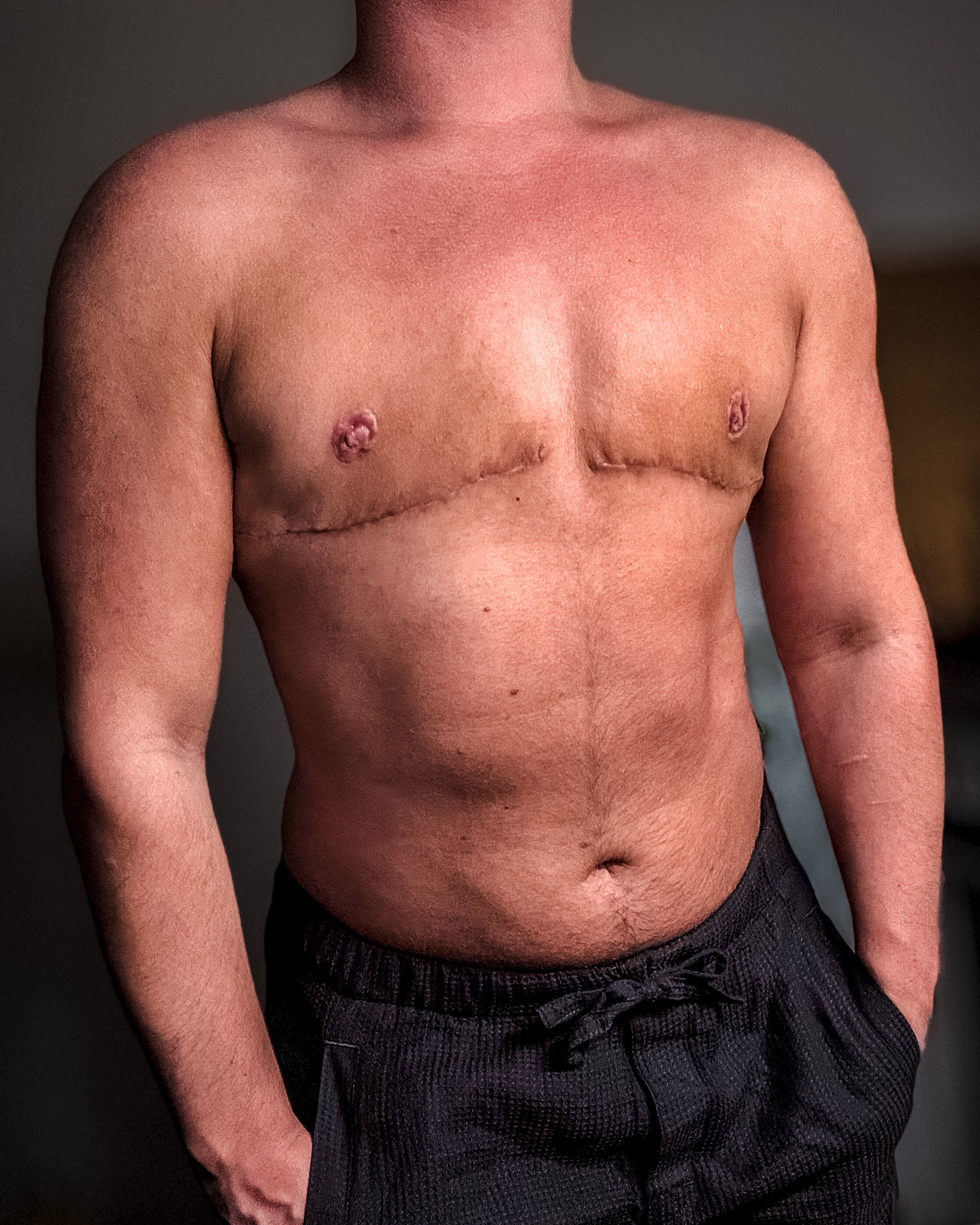 Help me get this off my chest! campaign photo, 6 of 8
