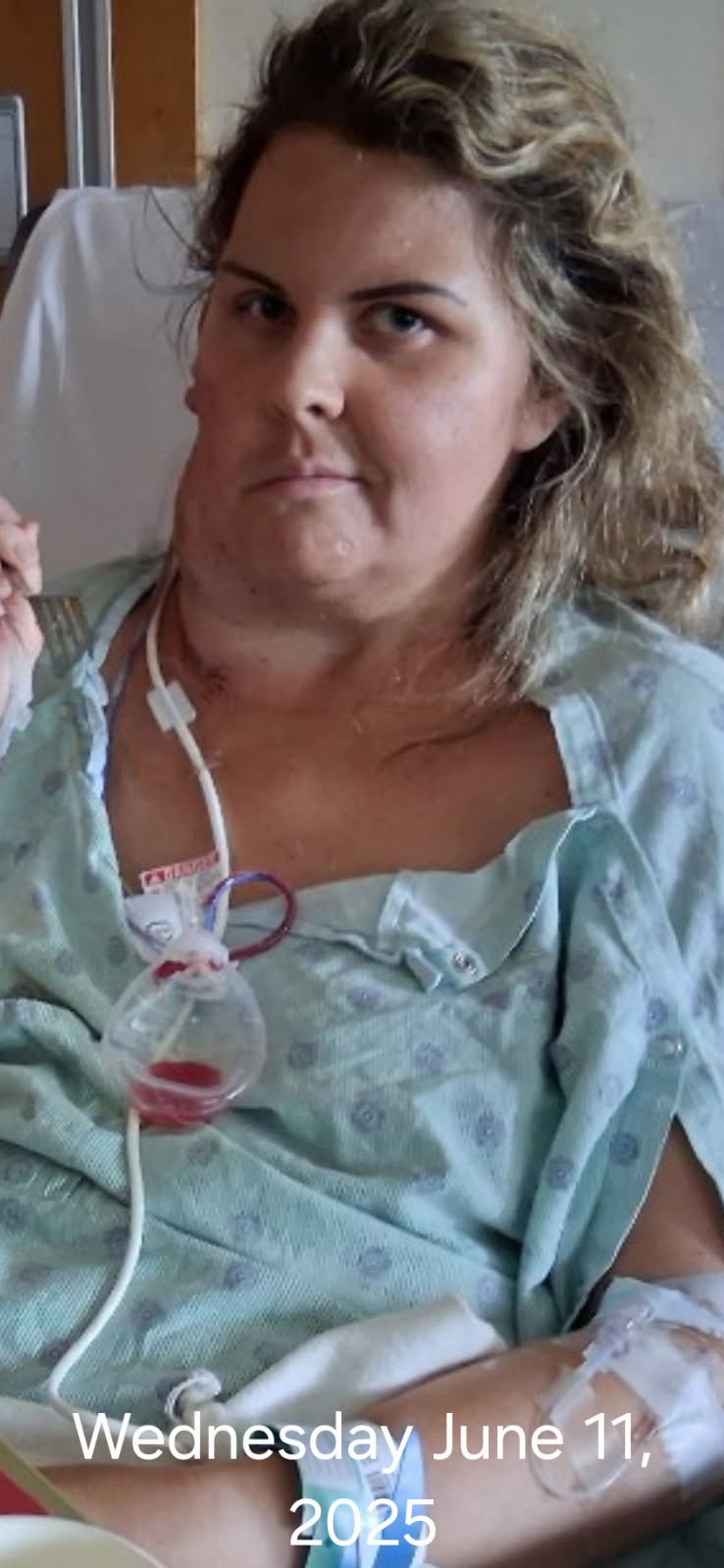 Stand by Linda: Cancer and Rising Expenses campaign photo, 2 of 8