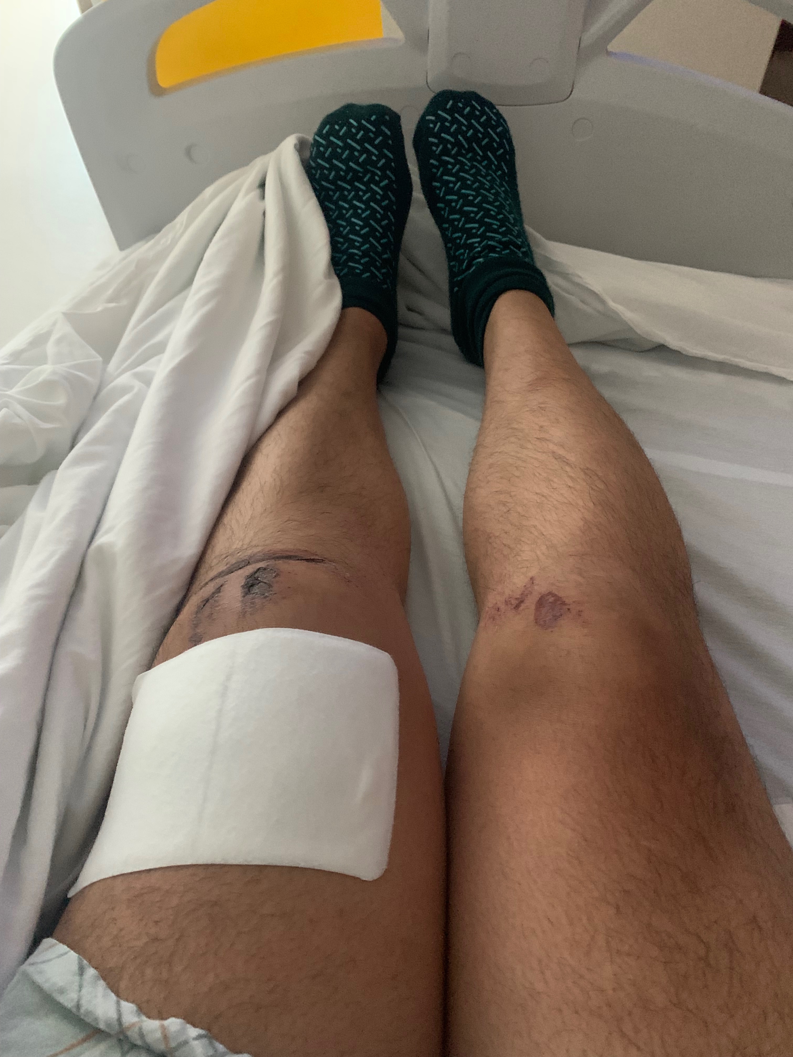Support Alexander's Recovery After Accident campaign photo, 2 of 8