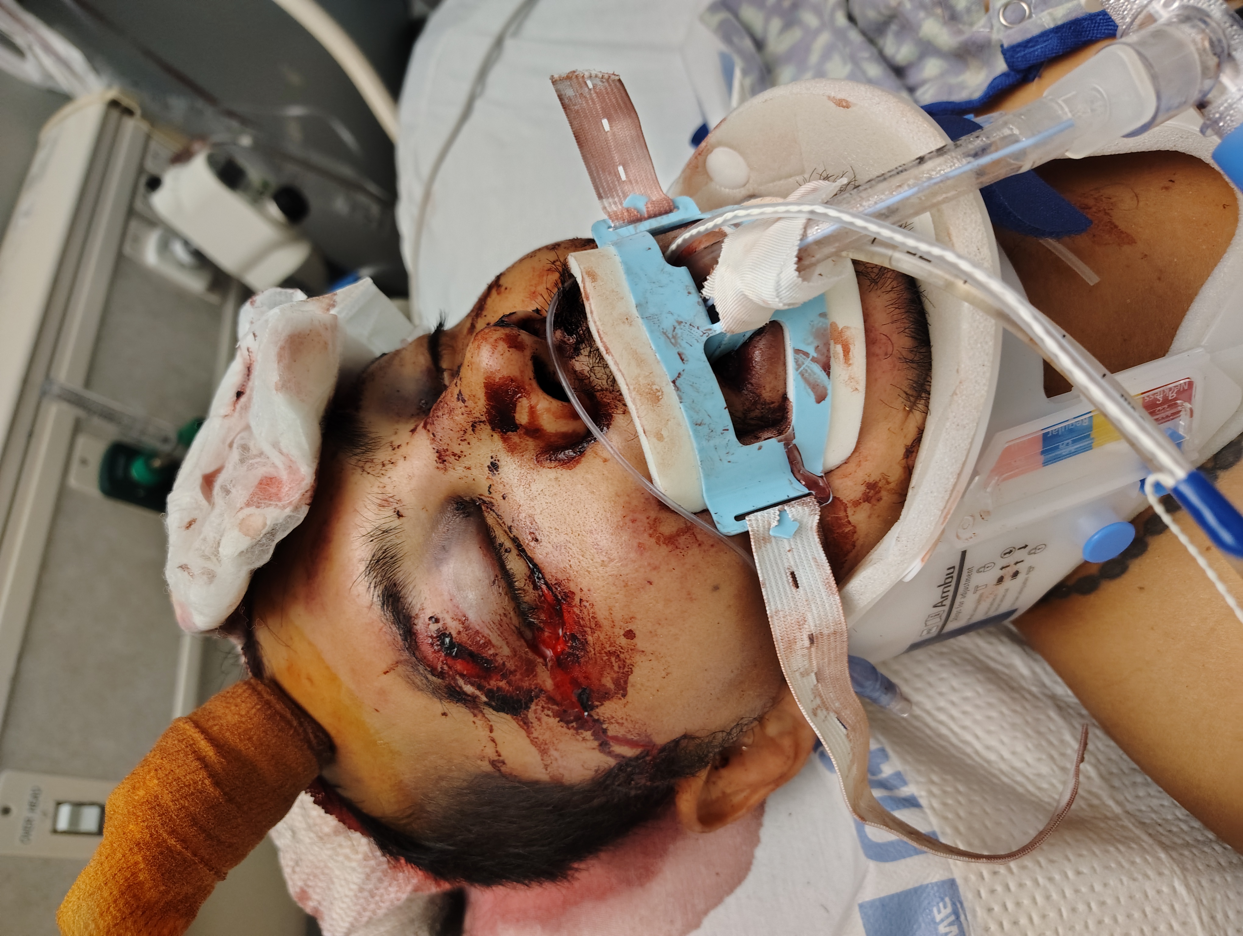 Aid for Rios Family: Oscar's ICU Battle campaign photo, 2 of 8