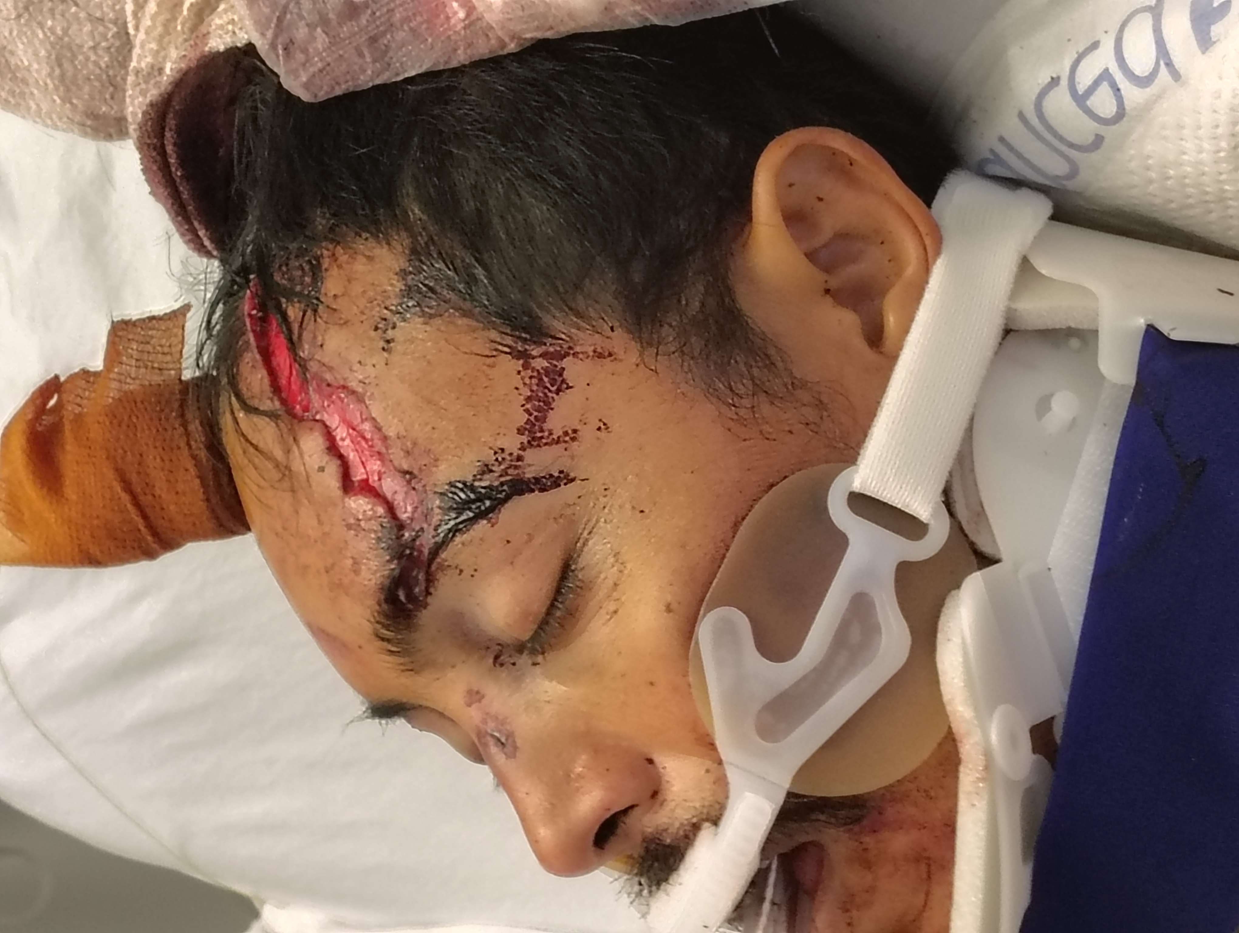Aid for Rios Family: Oscar's ICU Battle campaign photo, 4 of 8