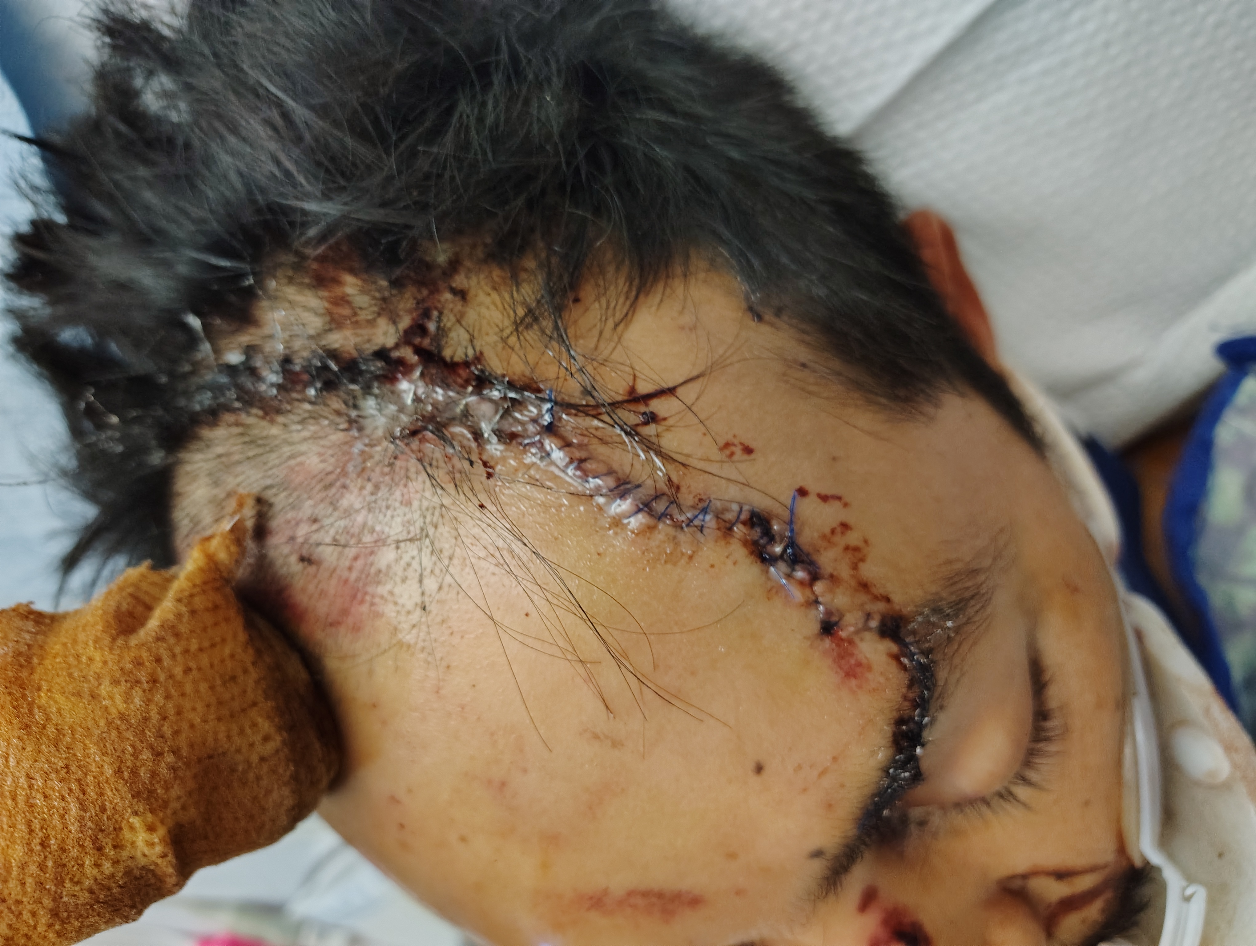 Aid for Rios Family: Oscar's ICU Battle campaign photo, 6 of 8