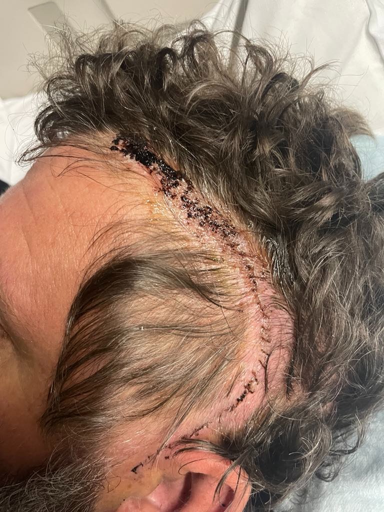 Please help the Lindsay's while Brad battles Cancer campaign photo, 4 of 8