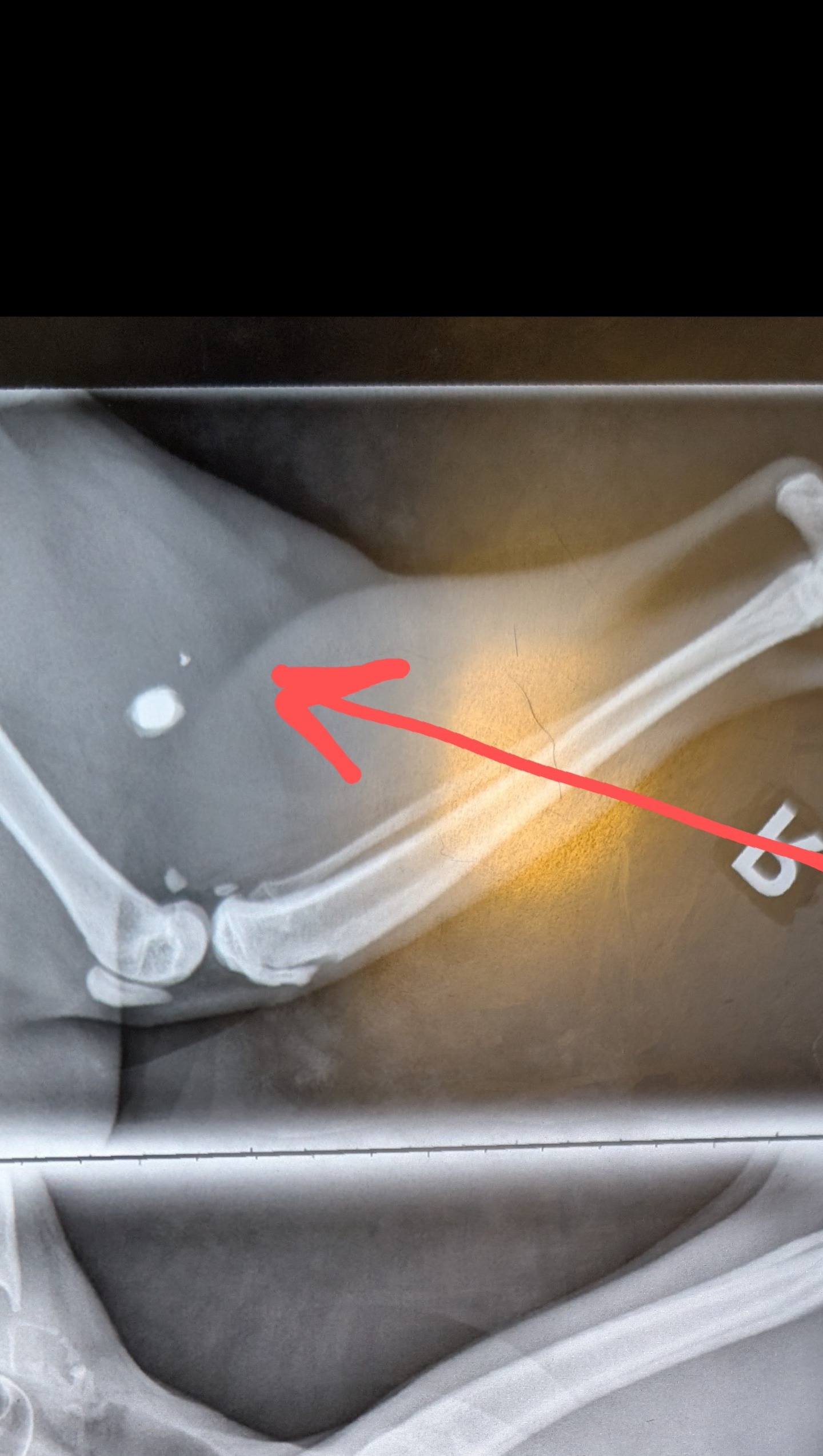 92456387_1751873617350148_r.