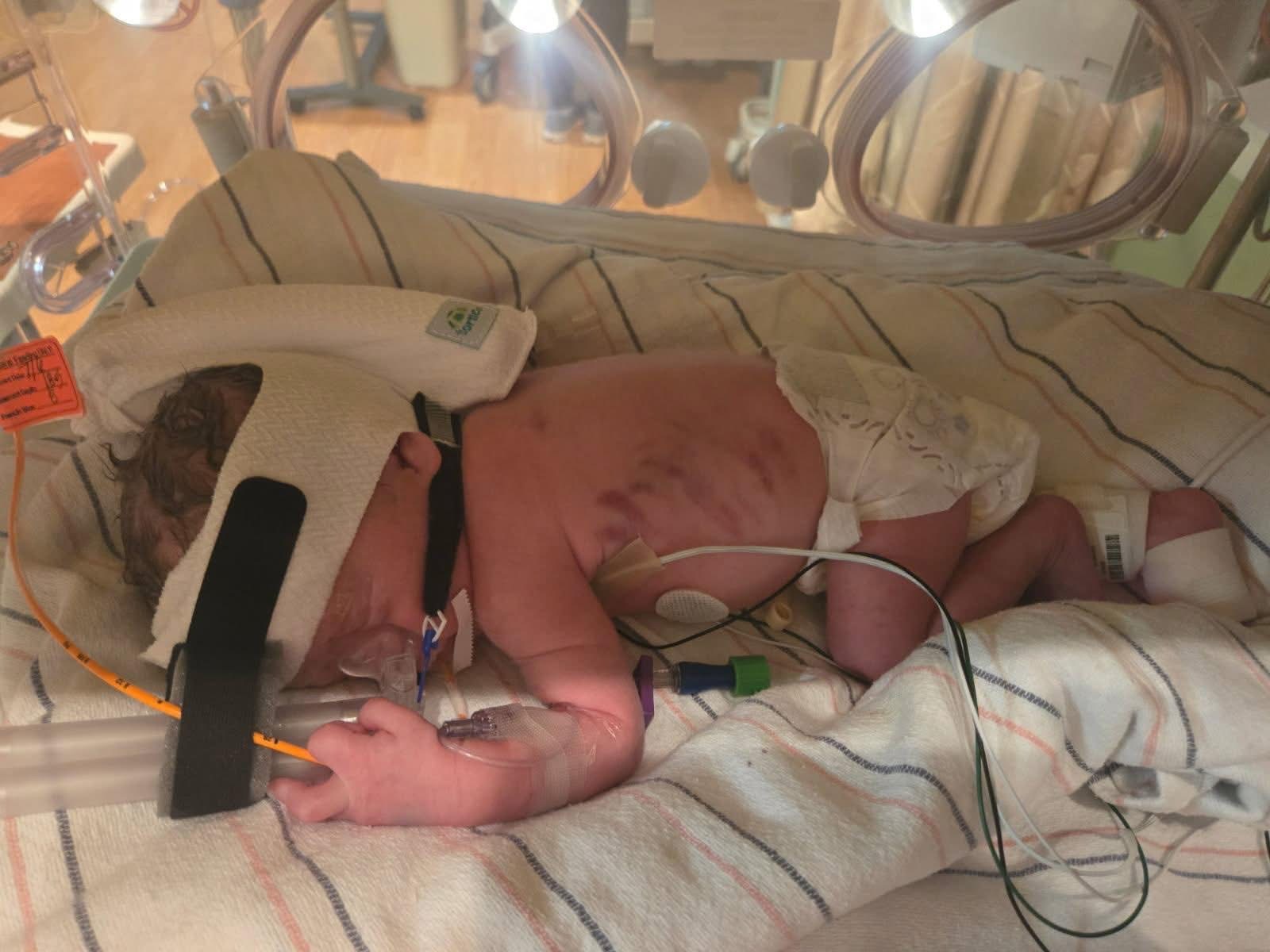 Support Newborn's NICU and Family's Recovery campaign photo, 6 of 7