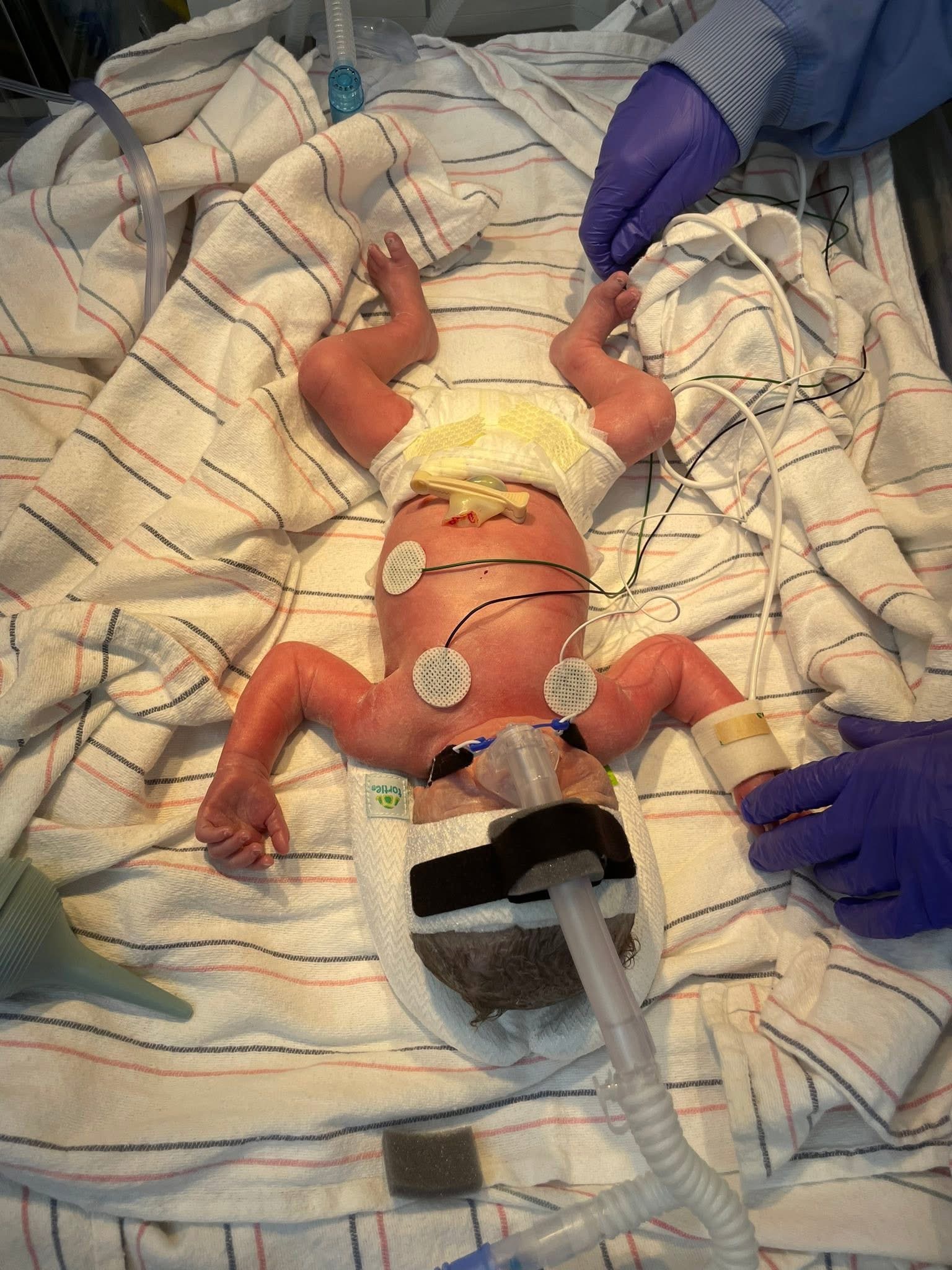 Support Newborn's NICU and Family's Recovery campaign photo, 4 of 7