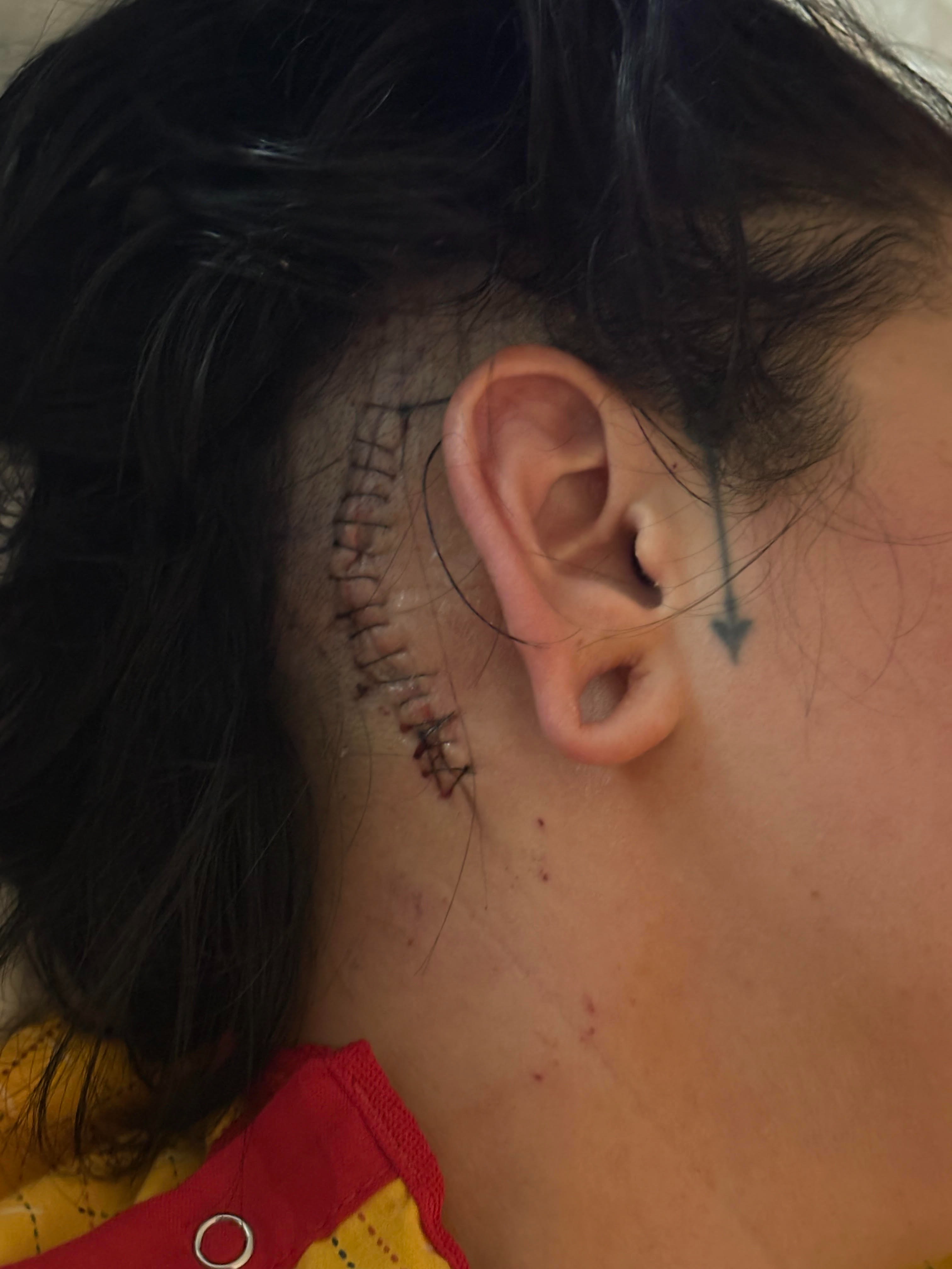Support Gabby's Recovery After Stroke campaign photo, 2 of 5