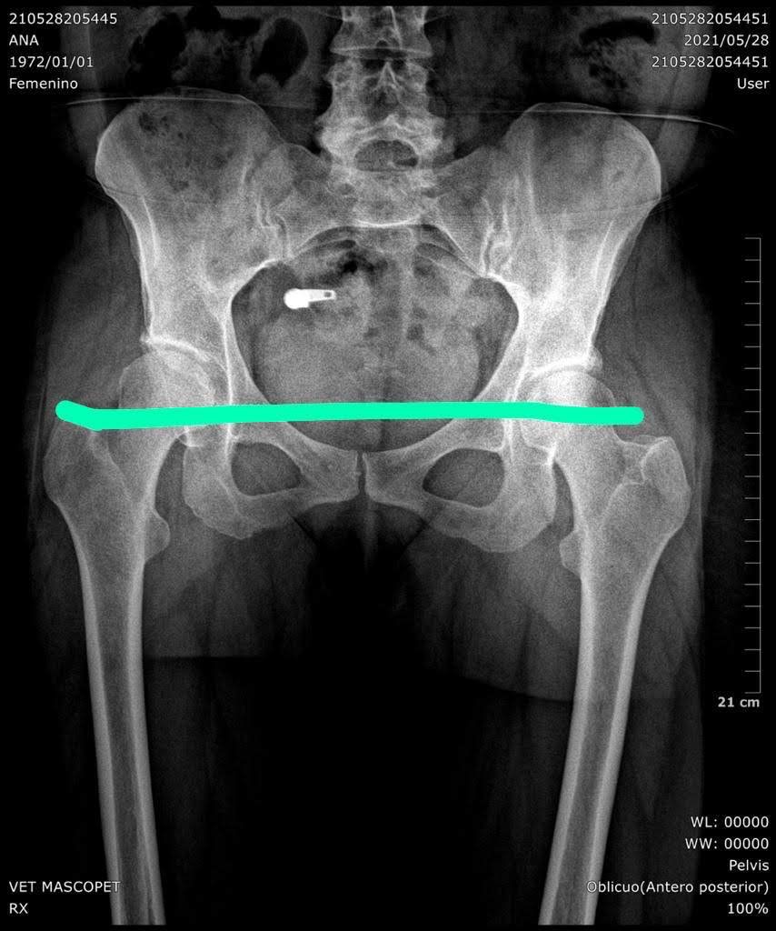 Foto de la campaña Una prótesis de cadera para seguir salvando vidas de 4 patas, 2 de 6