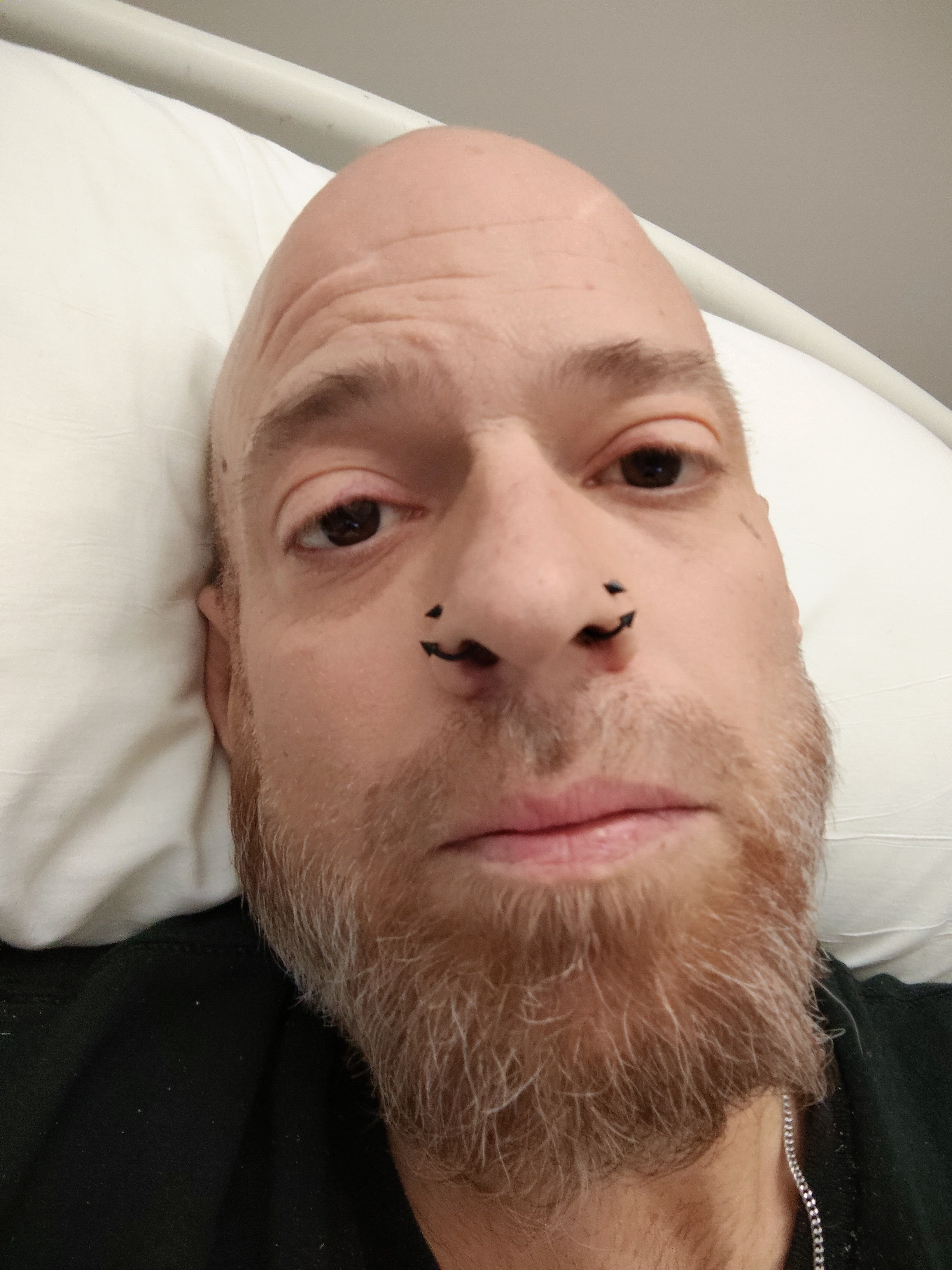 Donate to Harold's Liver Transplant Journey campaign photo, 5 of 8