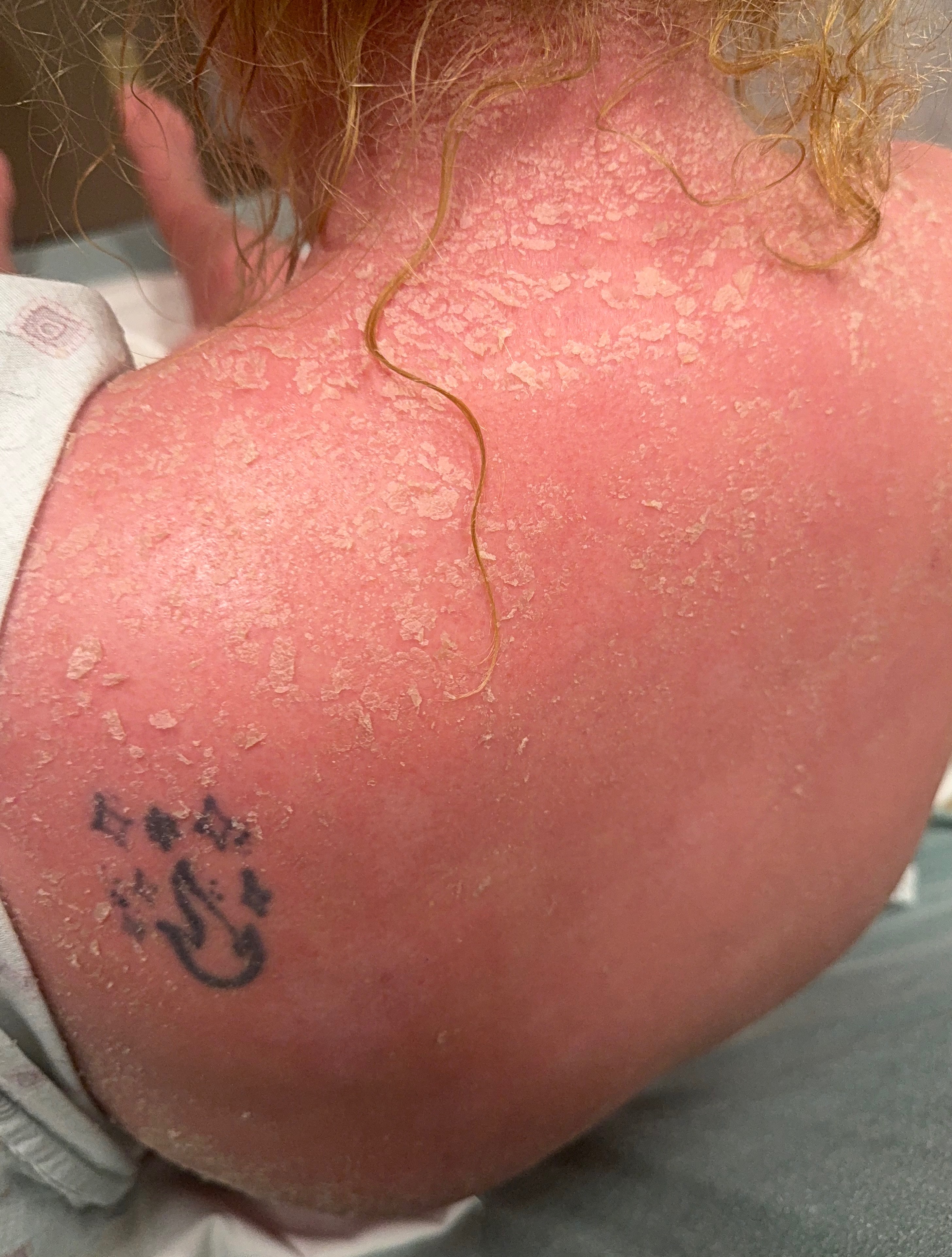 Donate to Nikki's Fight for a Normal Life campaign photo, 6 of 7