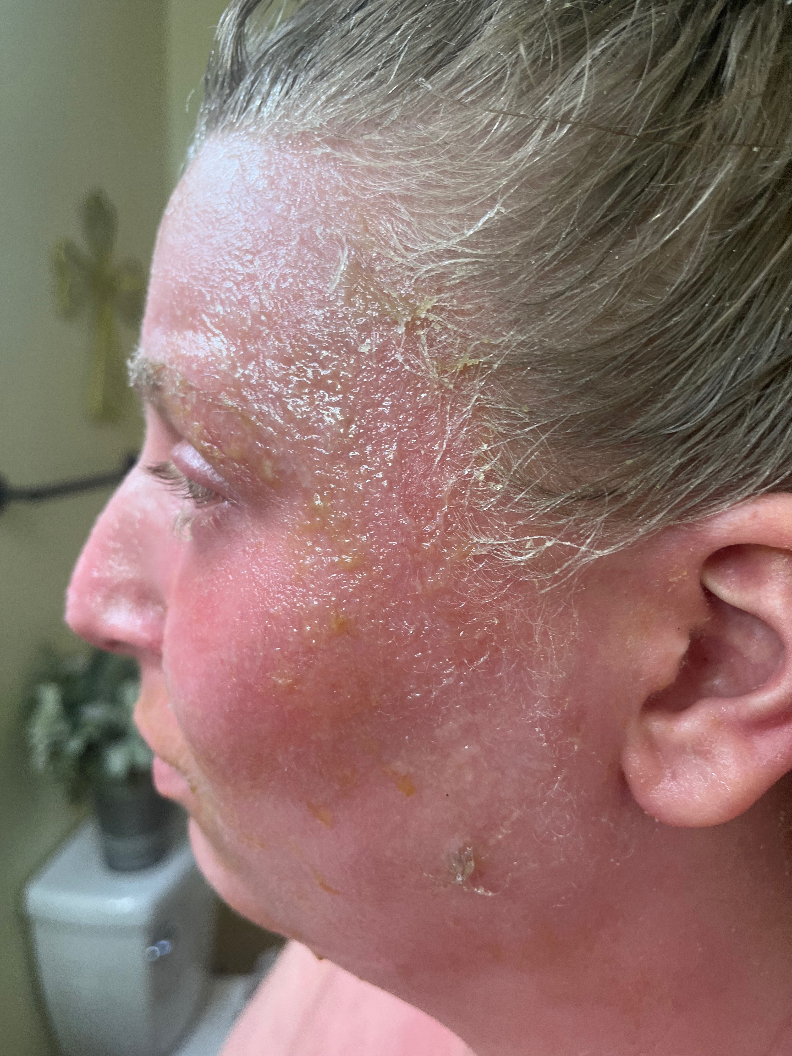 Donate to Nikki's Fight for a Normal Life campaign photo, 5 of 7