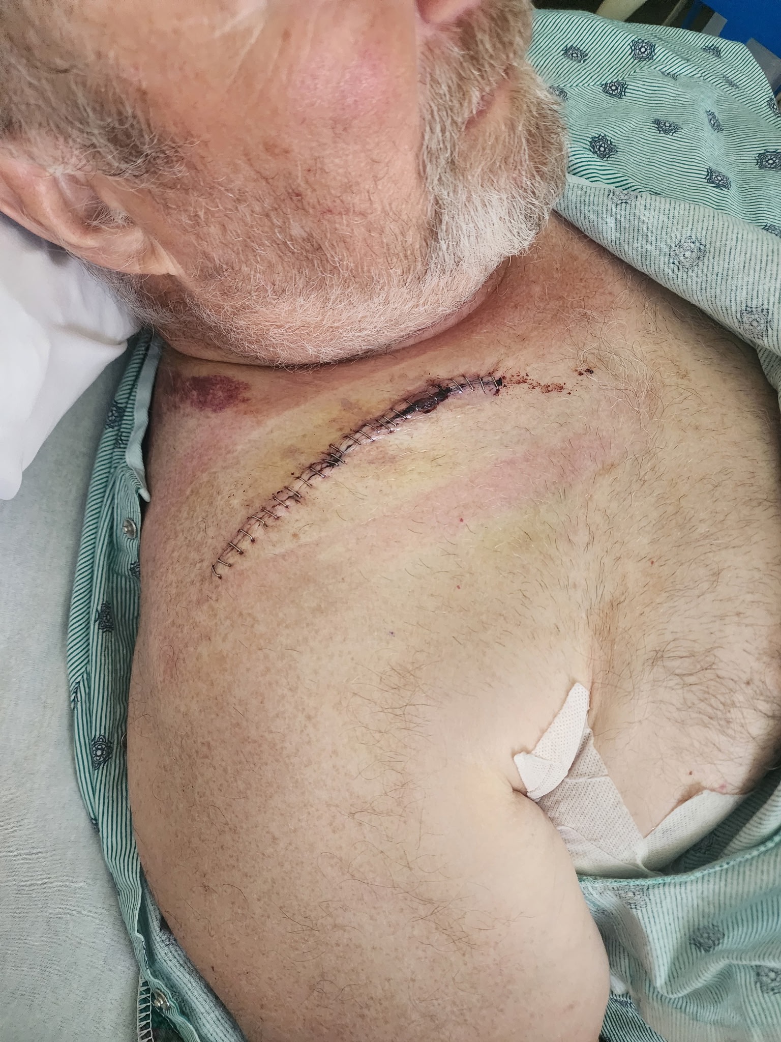 Support Richard Brasseaux’s Road to Recovery campaign photo, 7 of 8
