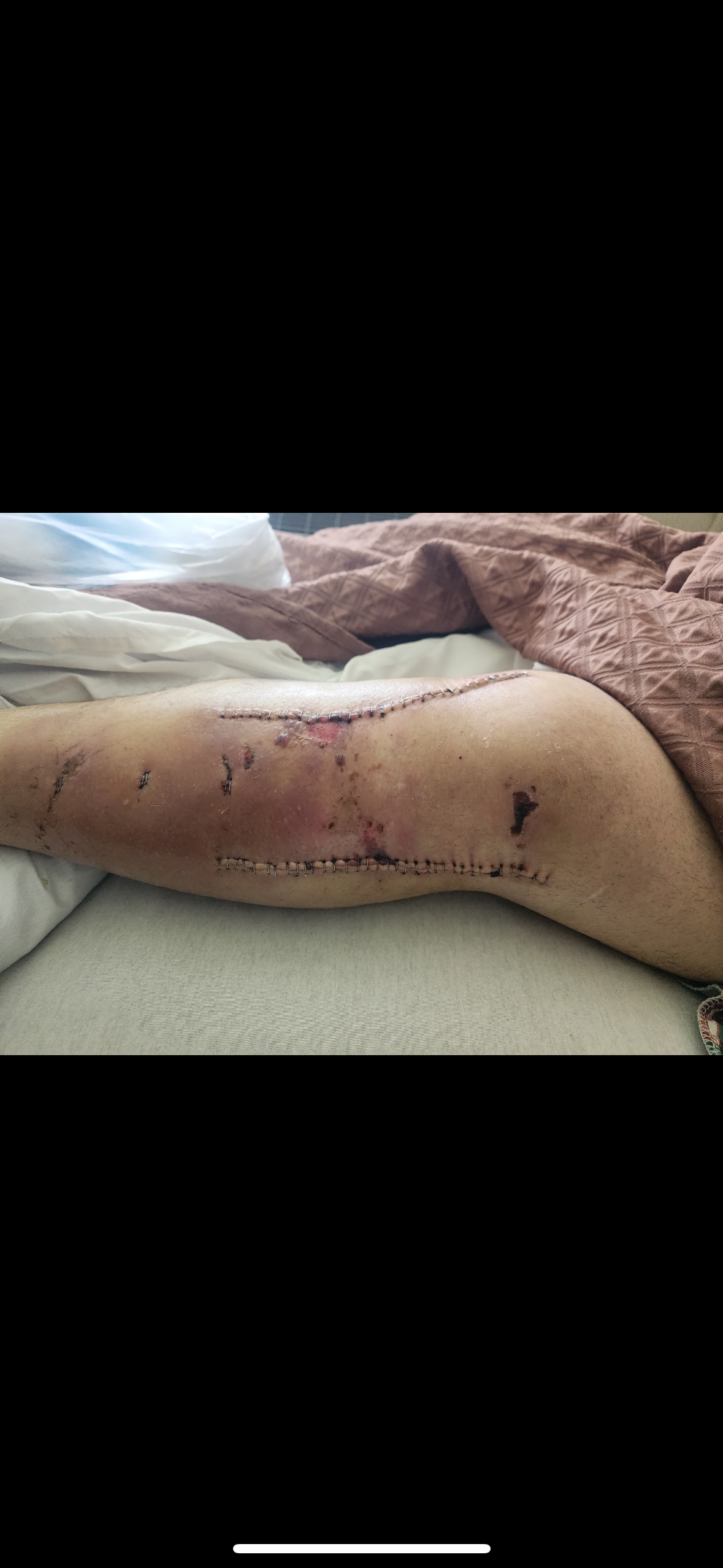 Support Richard Brasseaux’s Road to Recovery campaign photo, 2 of 8