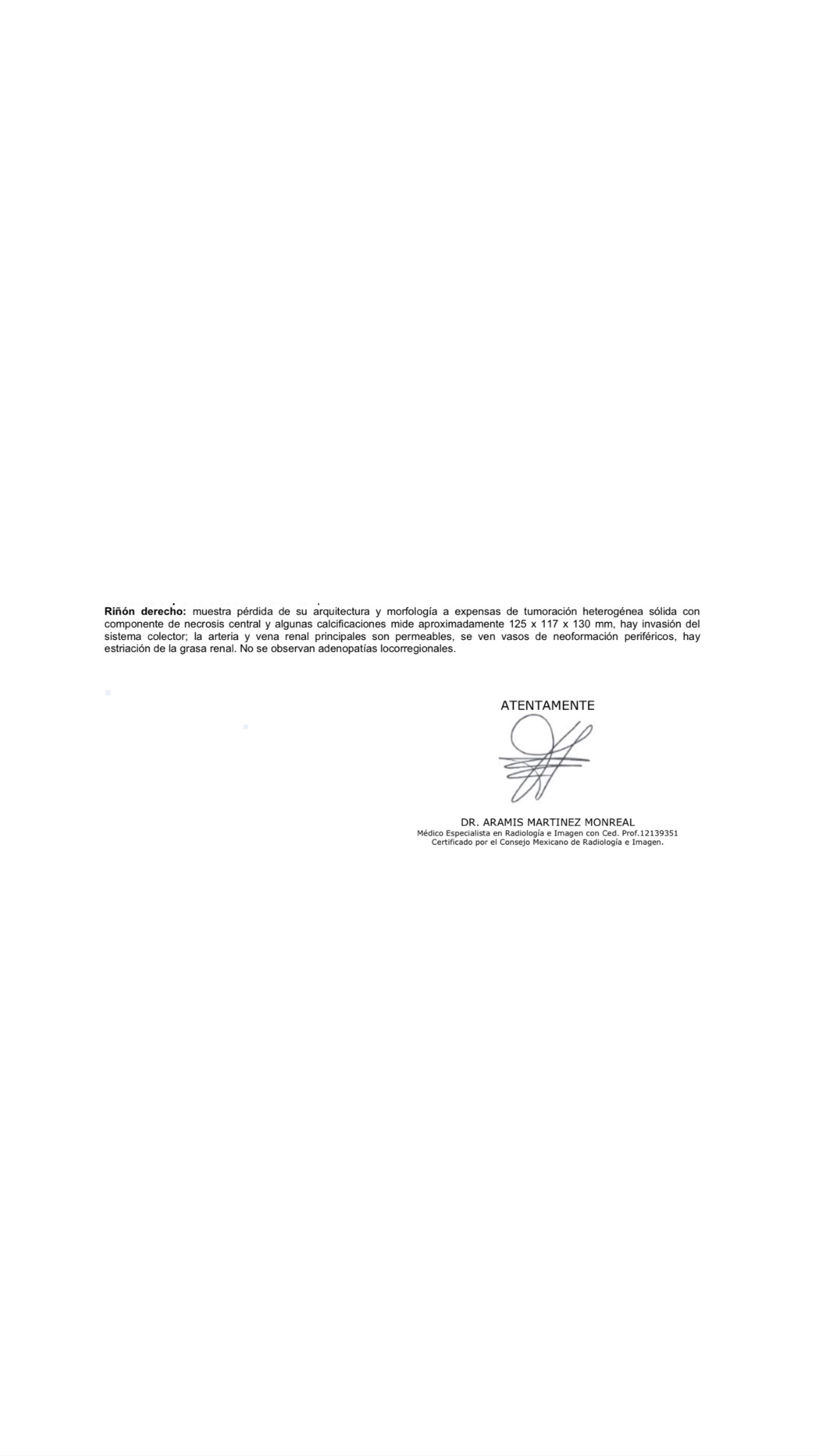 Apoyo médico para mi mamá: Tumor Renal campaign photo, 2 of 5