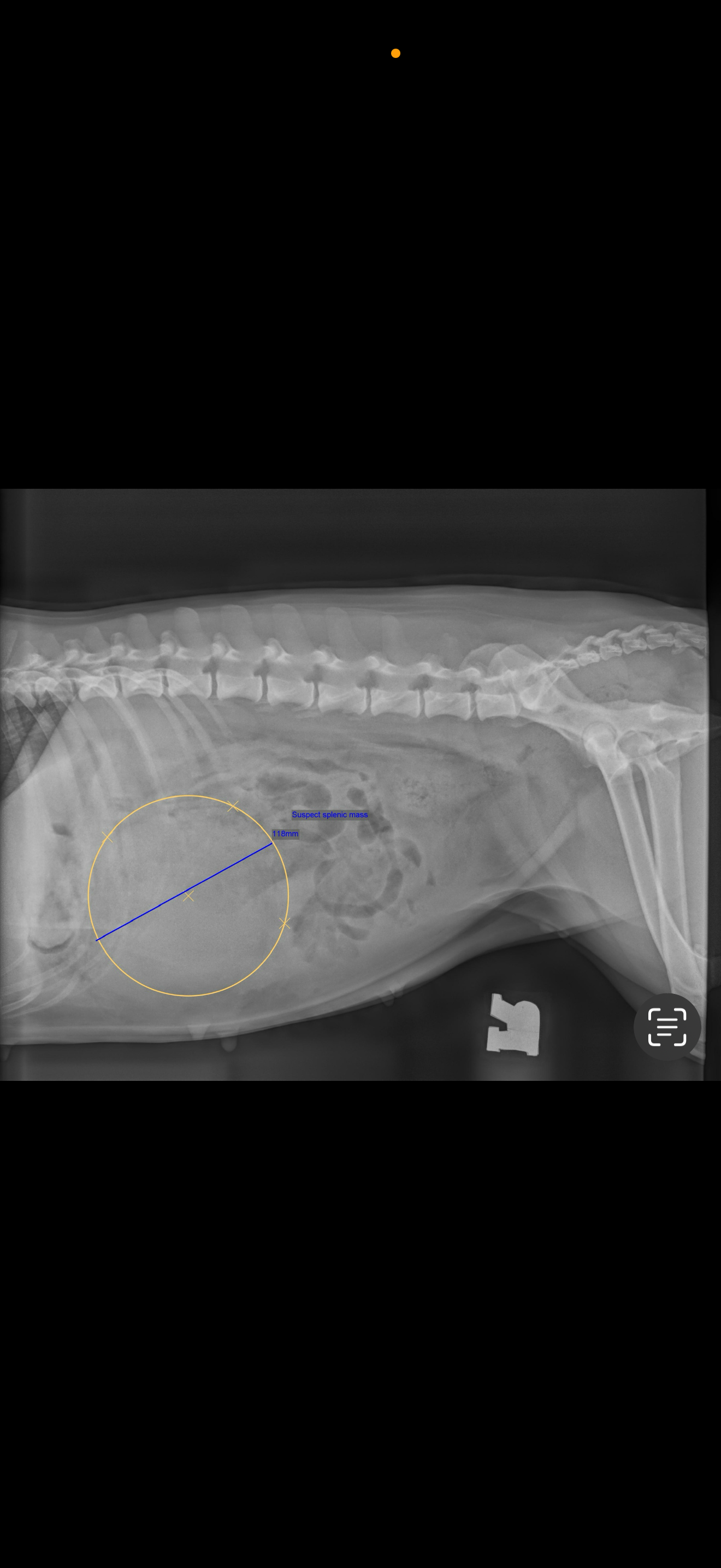 Save Zaagiin: Urgent Help Needed for Surgery campaign photo, 6 of 7
