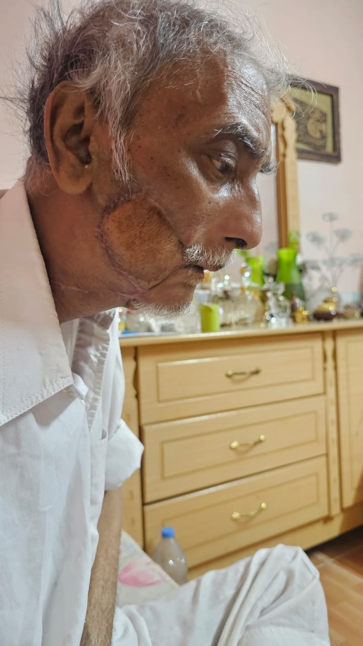 Help My Friend’s Father Fight for His Life After Jaw Removal campaign photo, 5 of 6