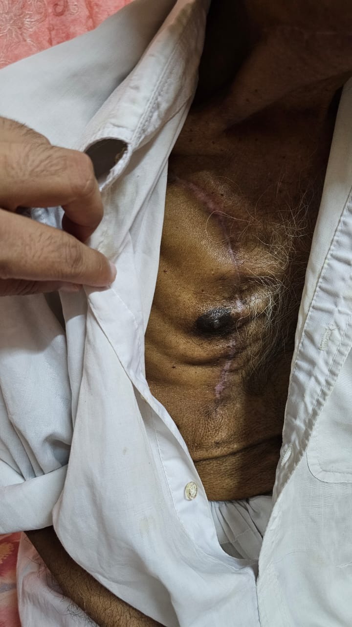 Help My Friend’s Father Fight for His Life After Jaw Removal campaign photo, 4 of 6