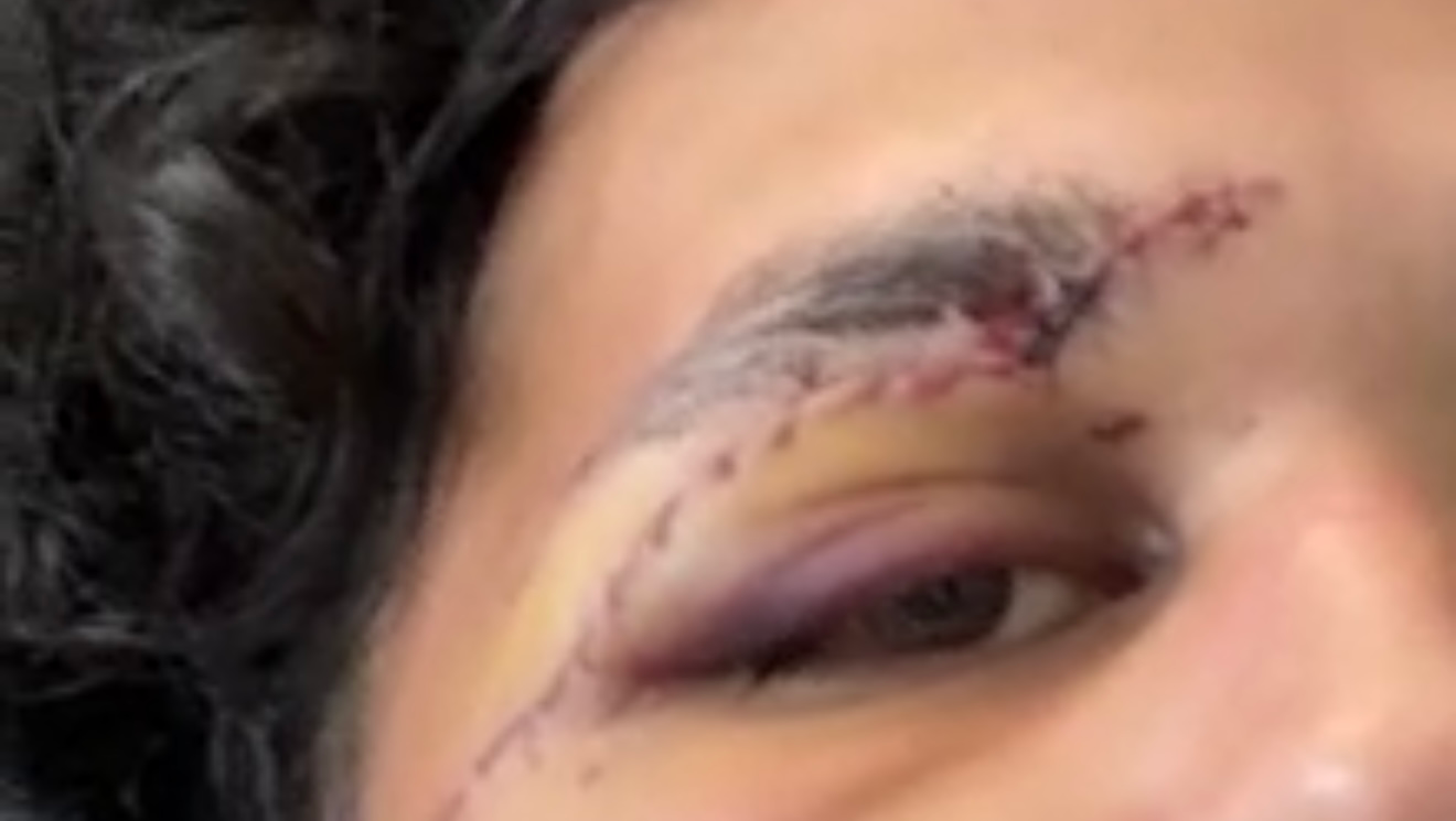 Support Kevin was stabbed nearly to death photo