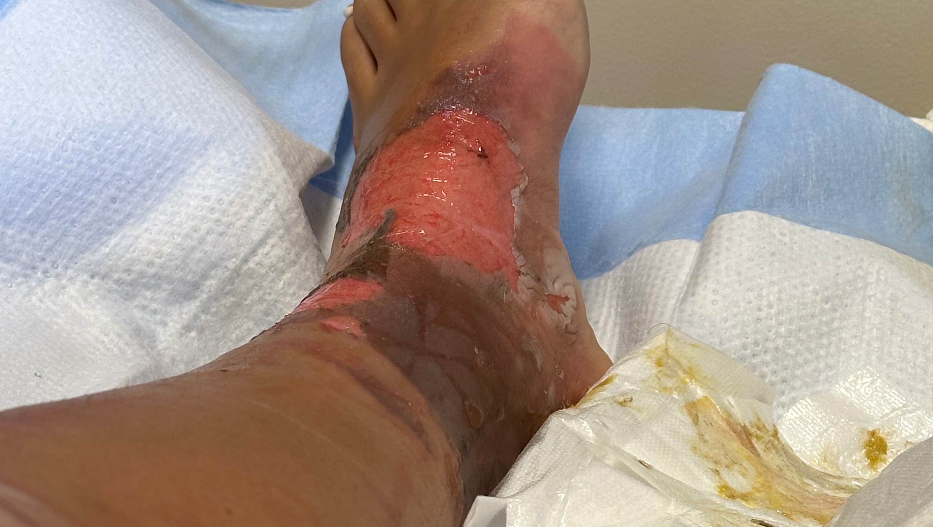 Donate to Lesly's Recovery and Family Needs photo