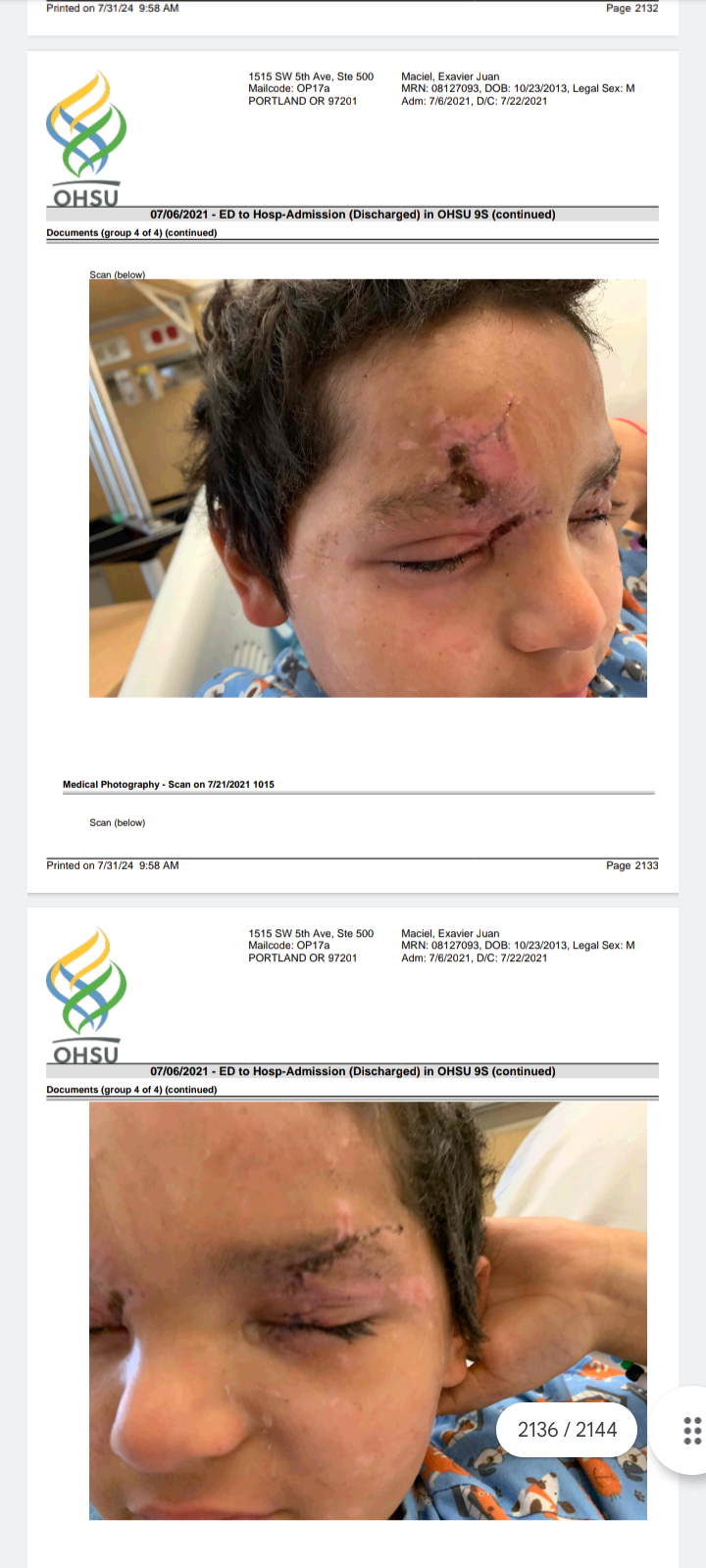 Fundraiser by Jessica Reyes : Support Exavier's Eye Surgery Journey