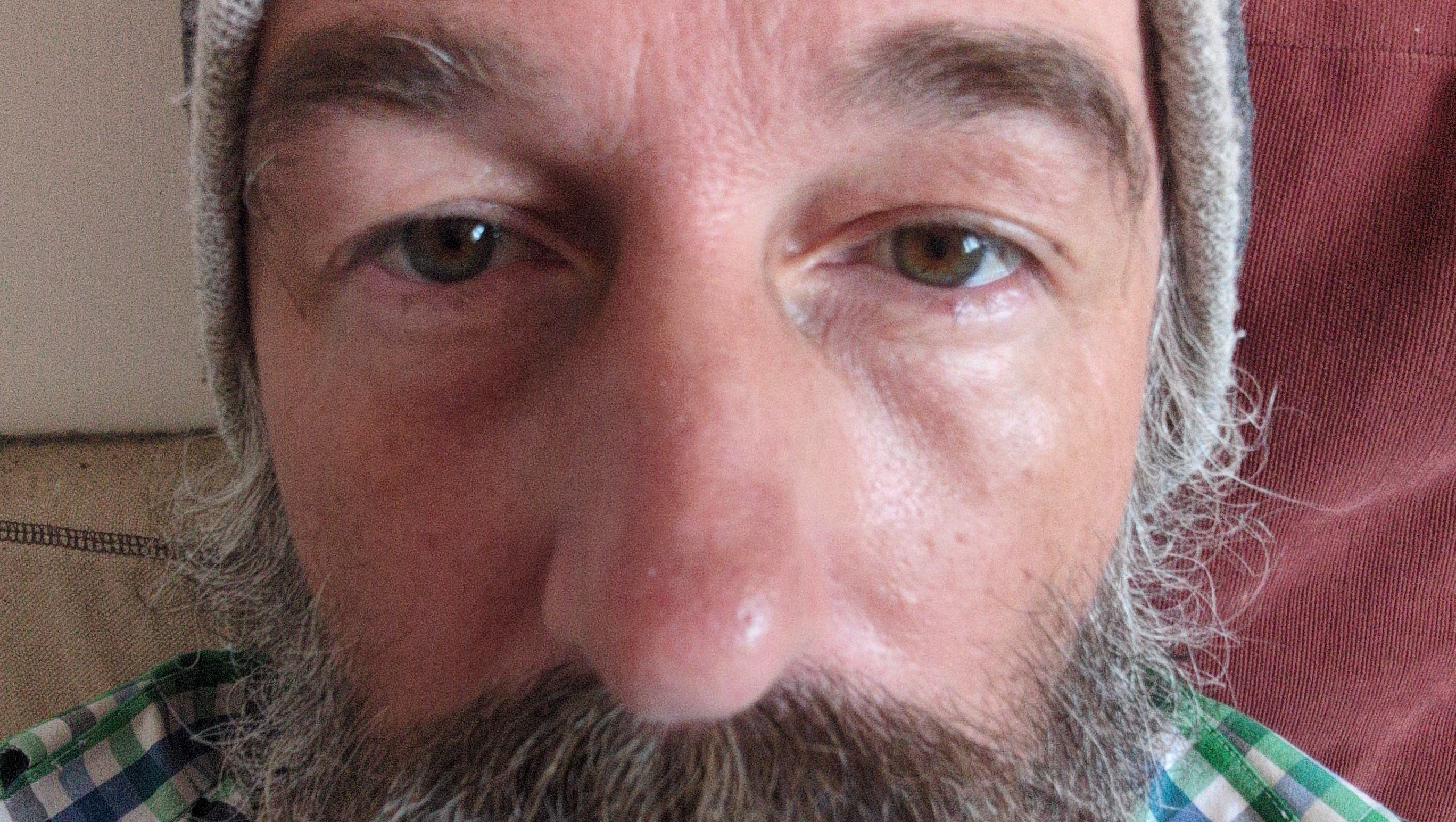 Donate and support me through DVT and blood clot recovery photo