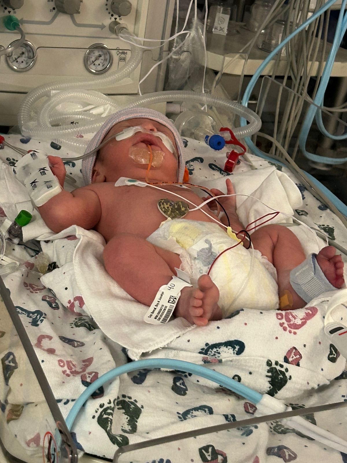 Help me improve my health (NICU) campaign photo, 5 of 6