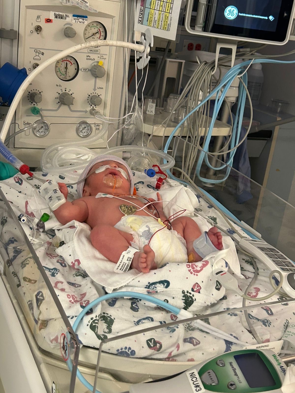 Help me improve my health (NICU) campaign photo, 2 of 6