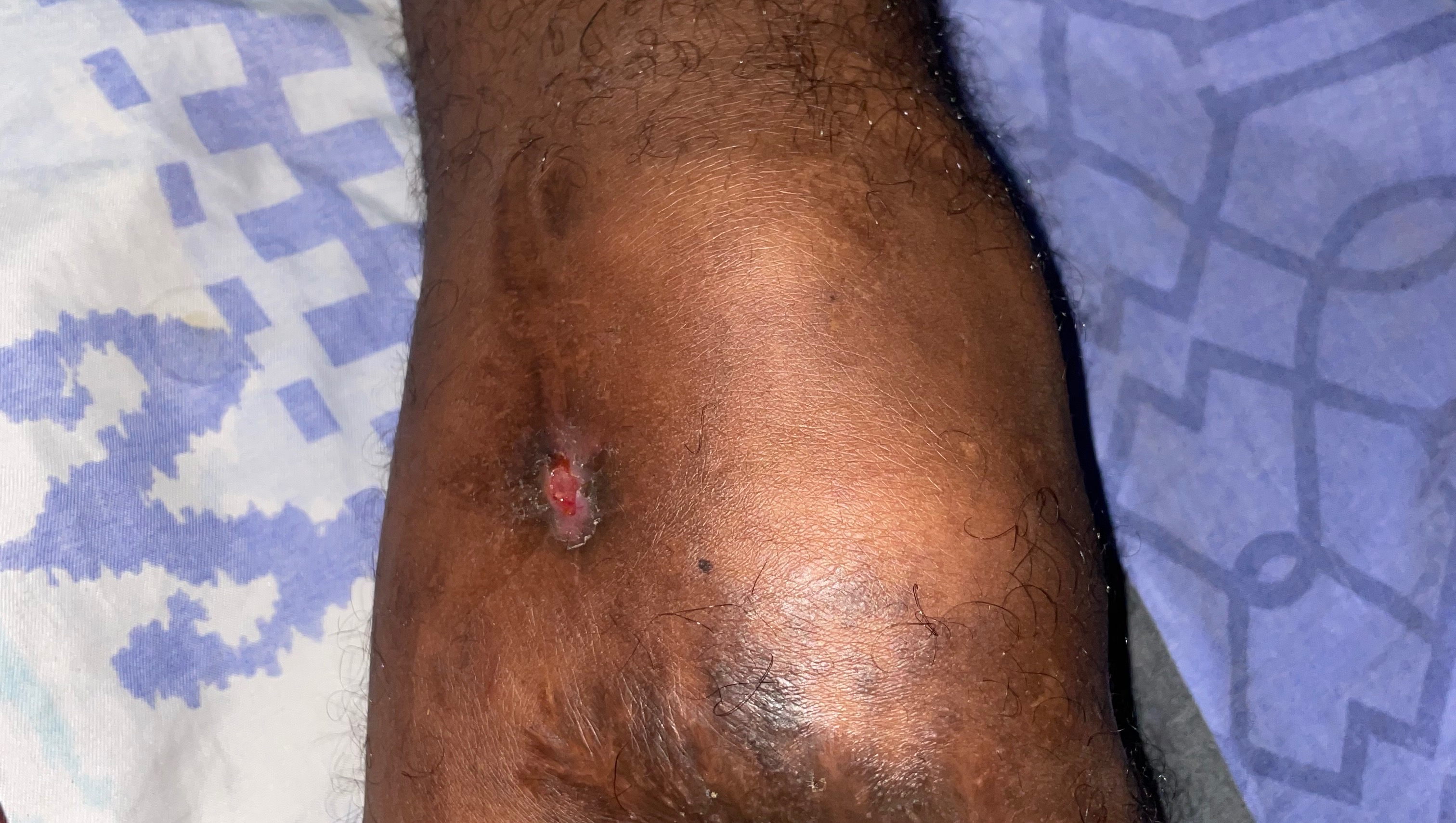 Para mi sobrino es muy urgente por favor photo