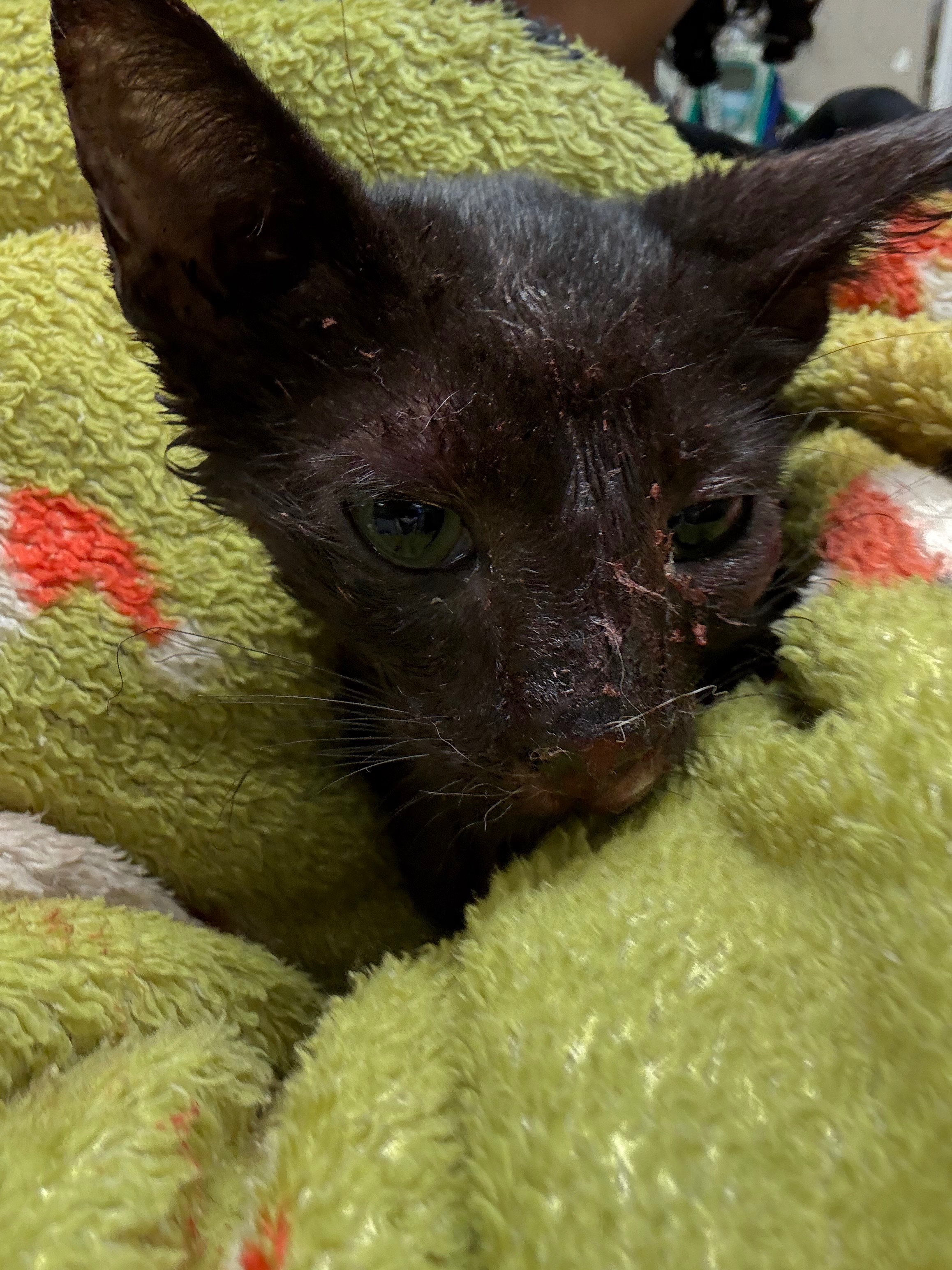 Broken, But Not Beaten: Beans Journey To Heal campaign photo, 2 of 8
