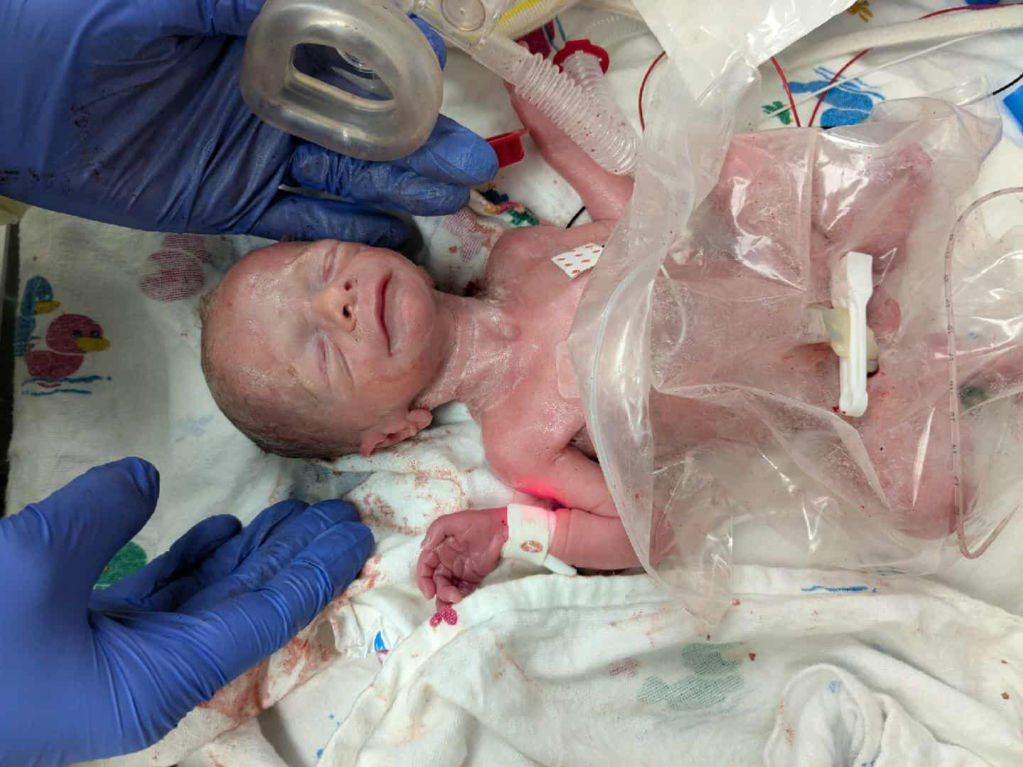 Support the DeatonBritt family's NICU Journey campaign photo, 4 of 5