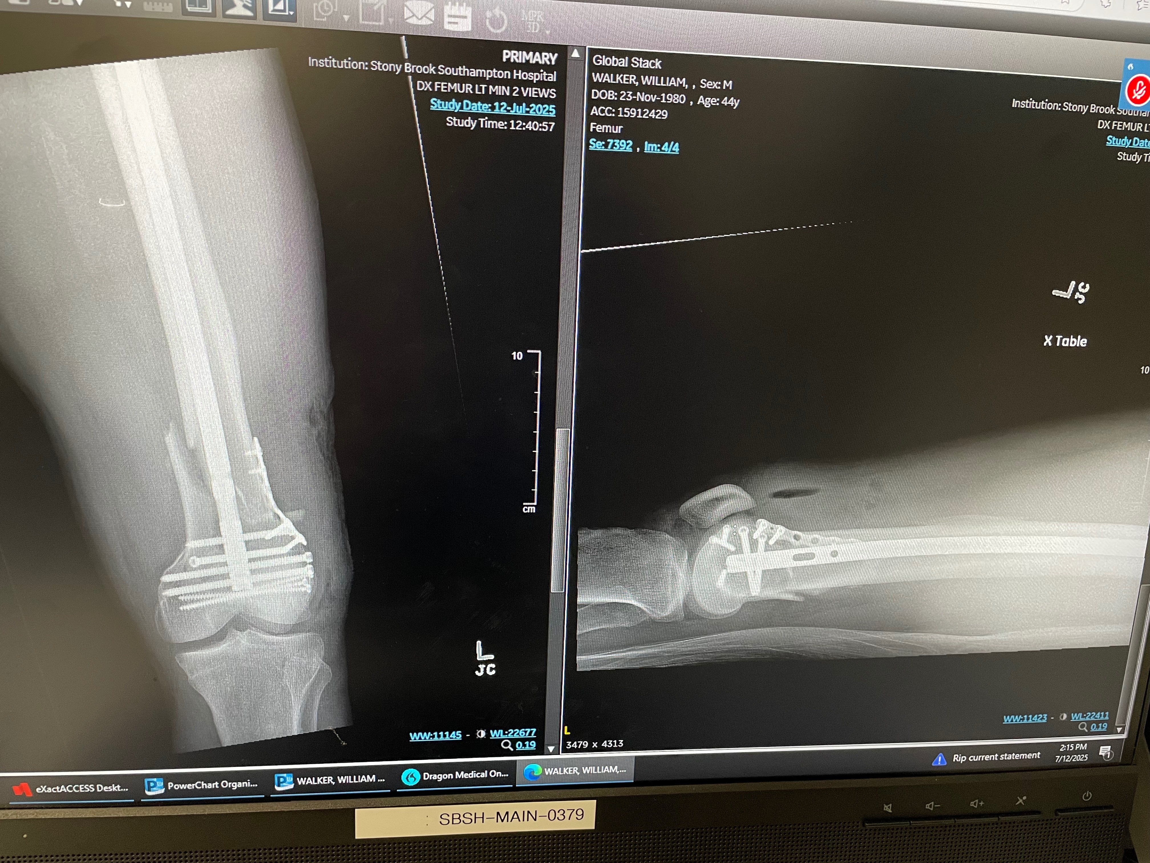 Victim of a hit and run campaign photo, 6 of 7