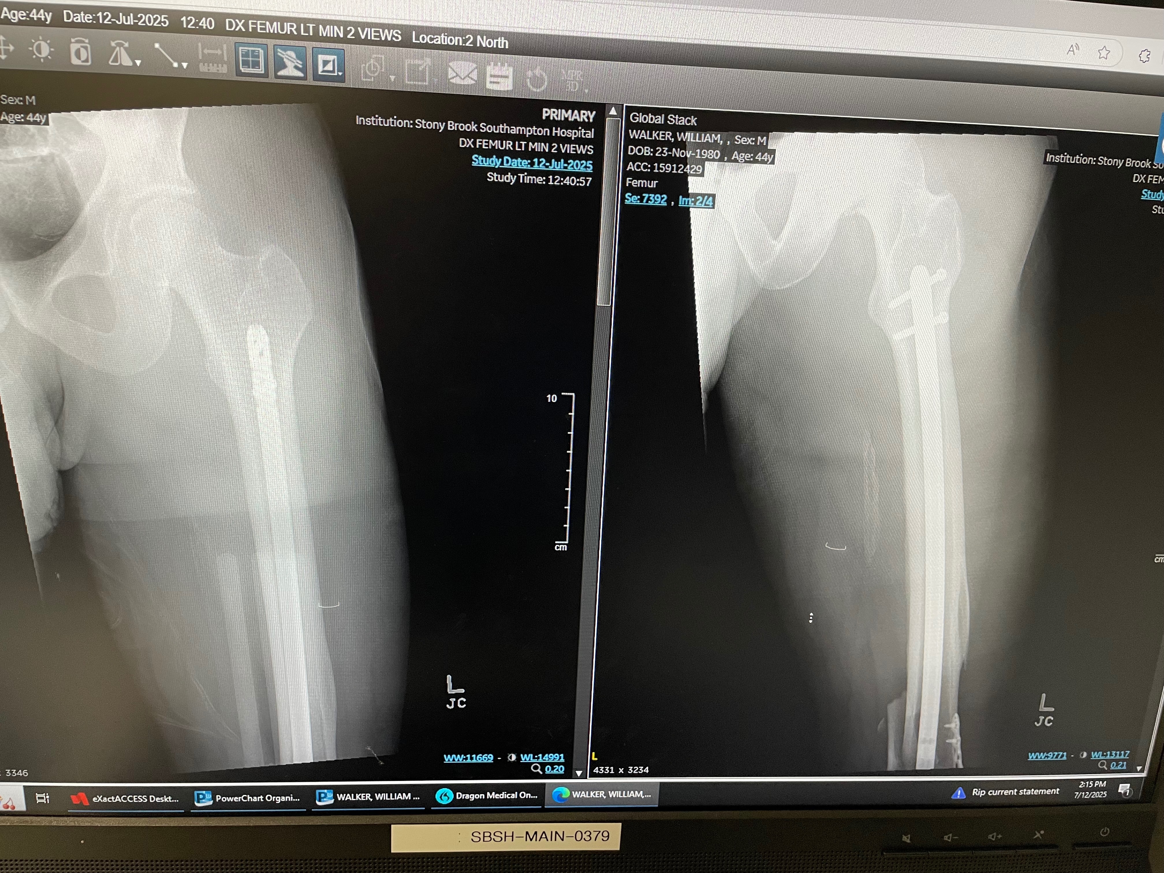 Victim of a hit and run campaign photo, 2 of 7