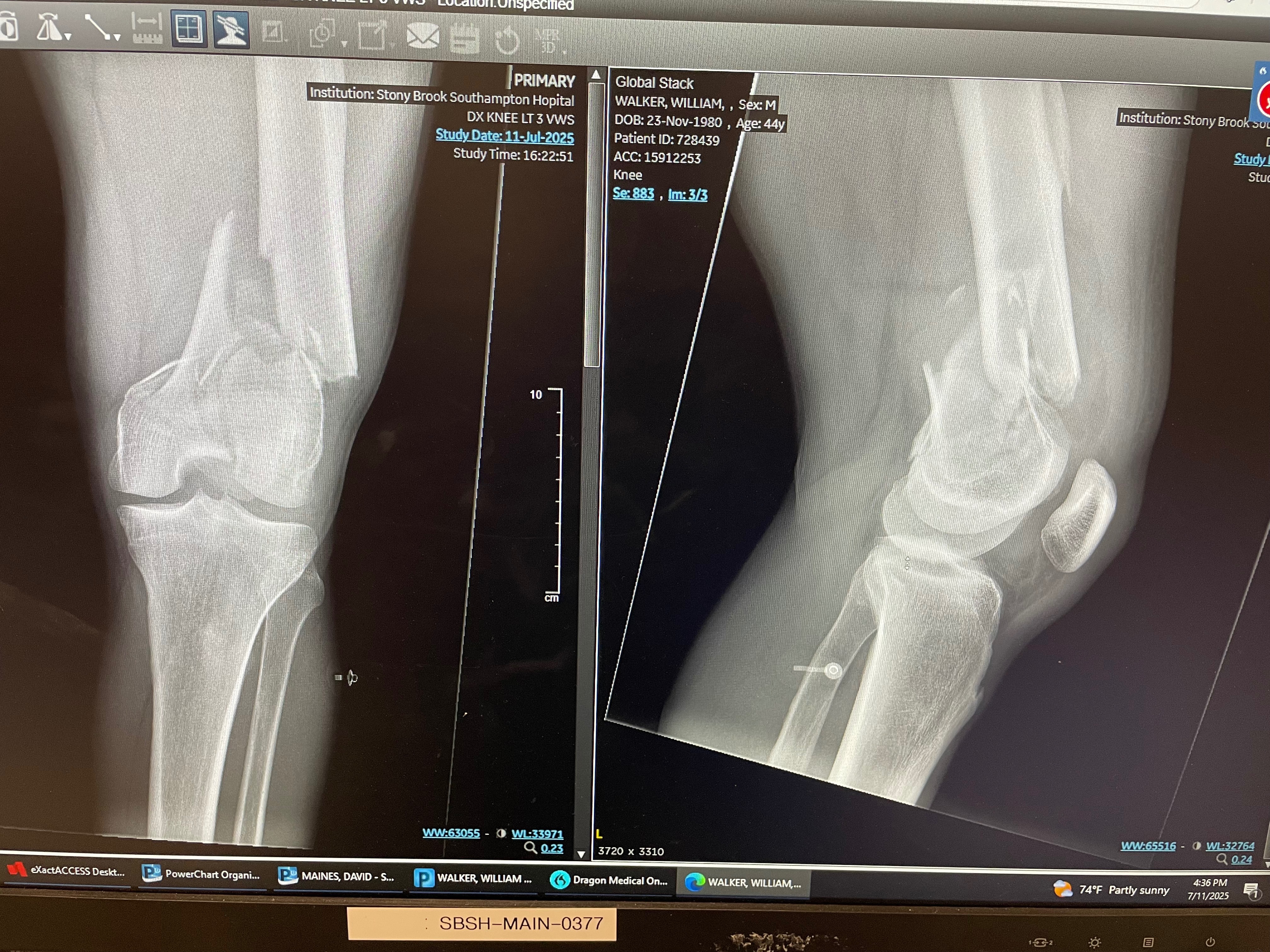 Victim of a hit and run campaign photo, 4 of 7