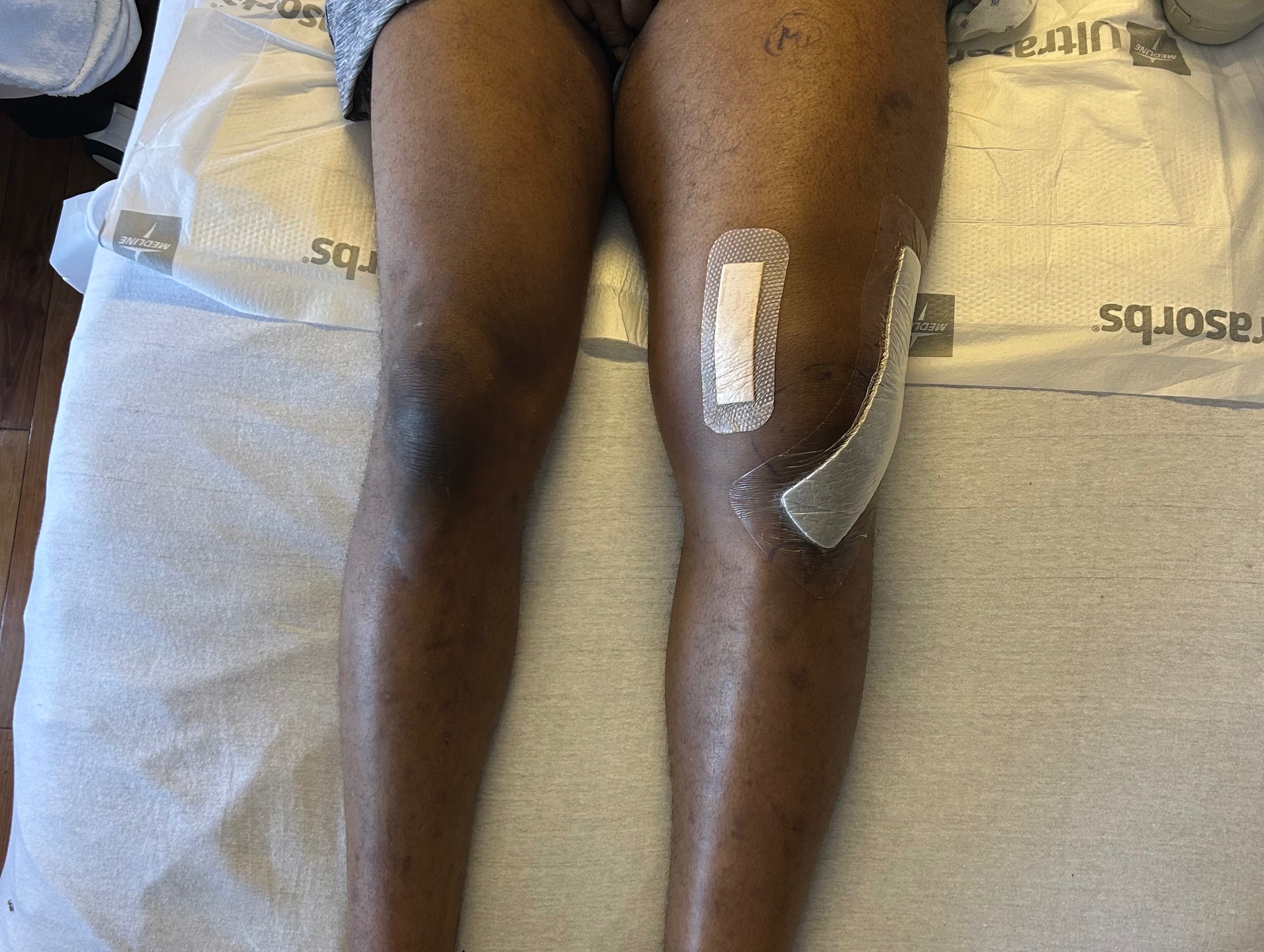 Victim of a hit and run campaign photo, 5 of 7