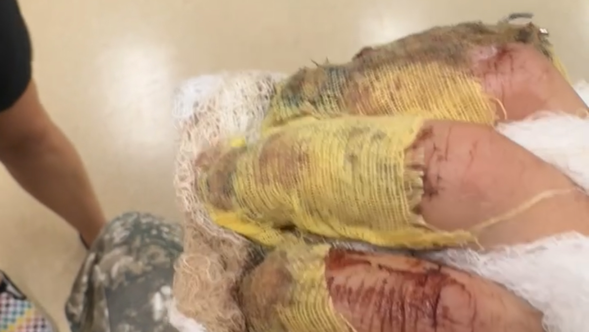 Help Dom On The Road To Recovery