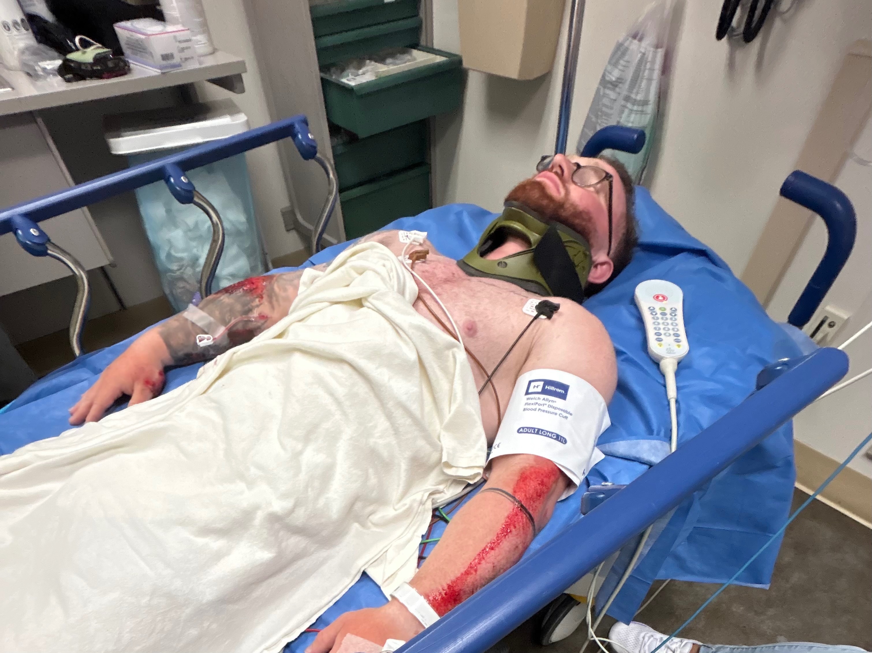 Support Justin's Recovery After Hit-and-Run campaign photo, 2 of 4