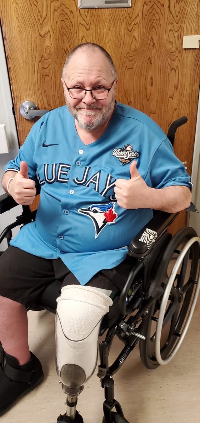 Amputation to left leg below knee, due to Diabetes disease campaign photo, 2 of 5