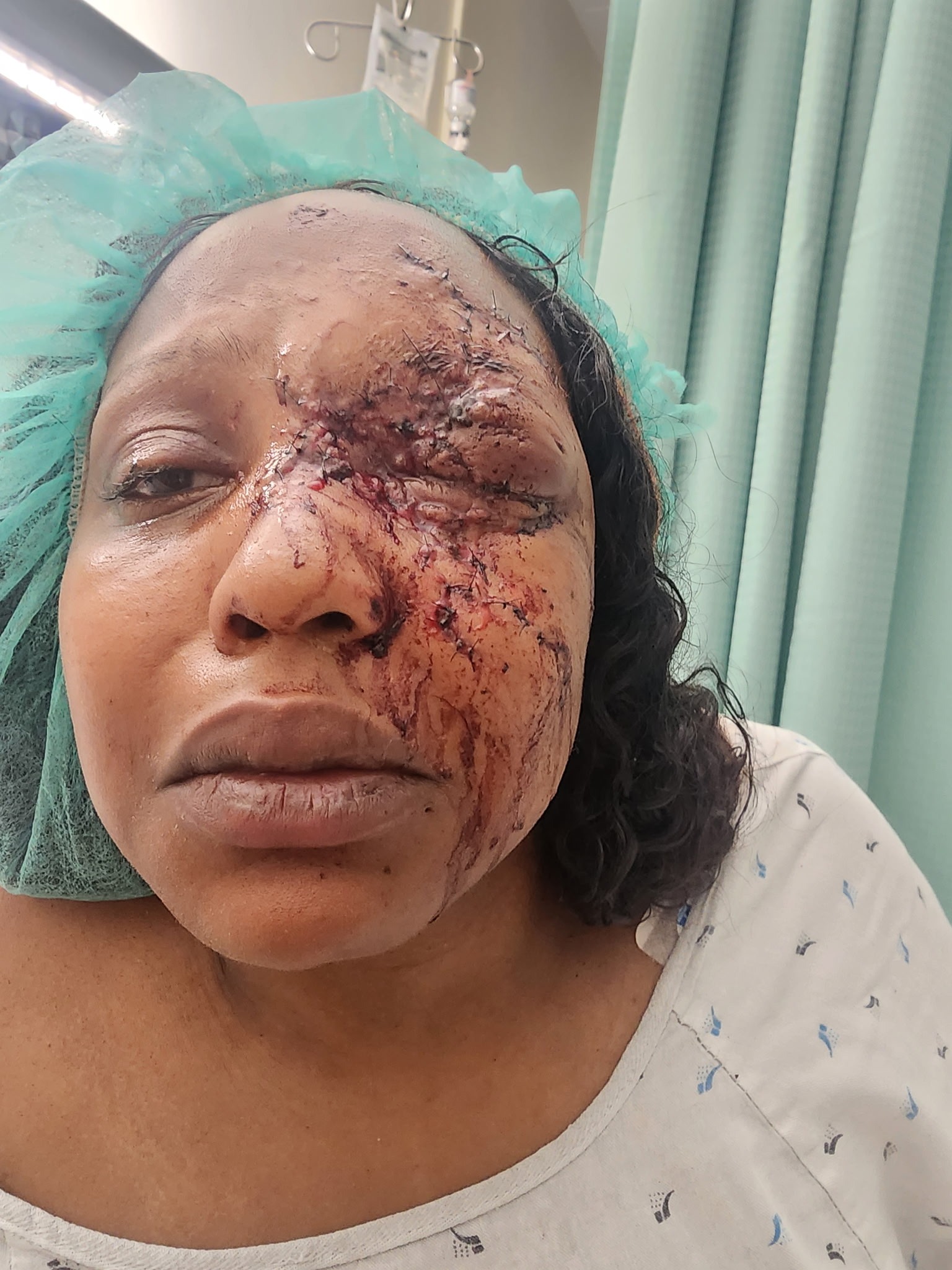 Help Ahykra Jackson Heal and Care for Her Kids campaign photo, 2 of 6